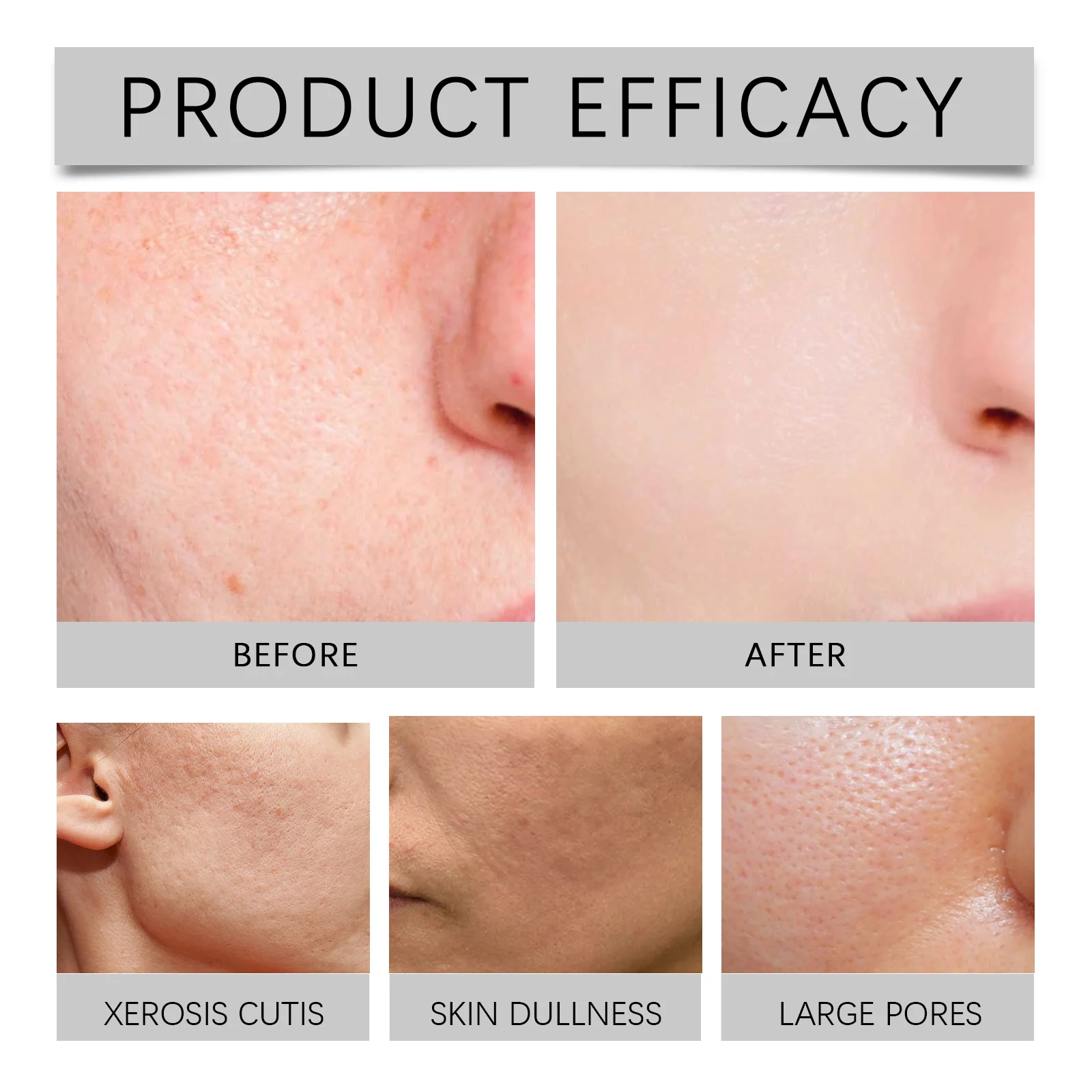2% Hyaluronic Acid Serum Hydrating Face Serum with Vitamin B5 and Ceramides 30ml 8 2 percent hyaluronic acid serum hydrating face serum 30ml cih 5x83ducr desc 8