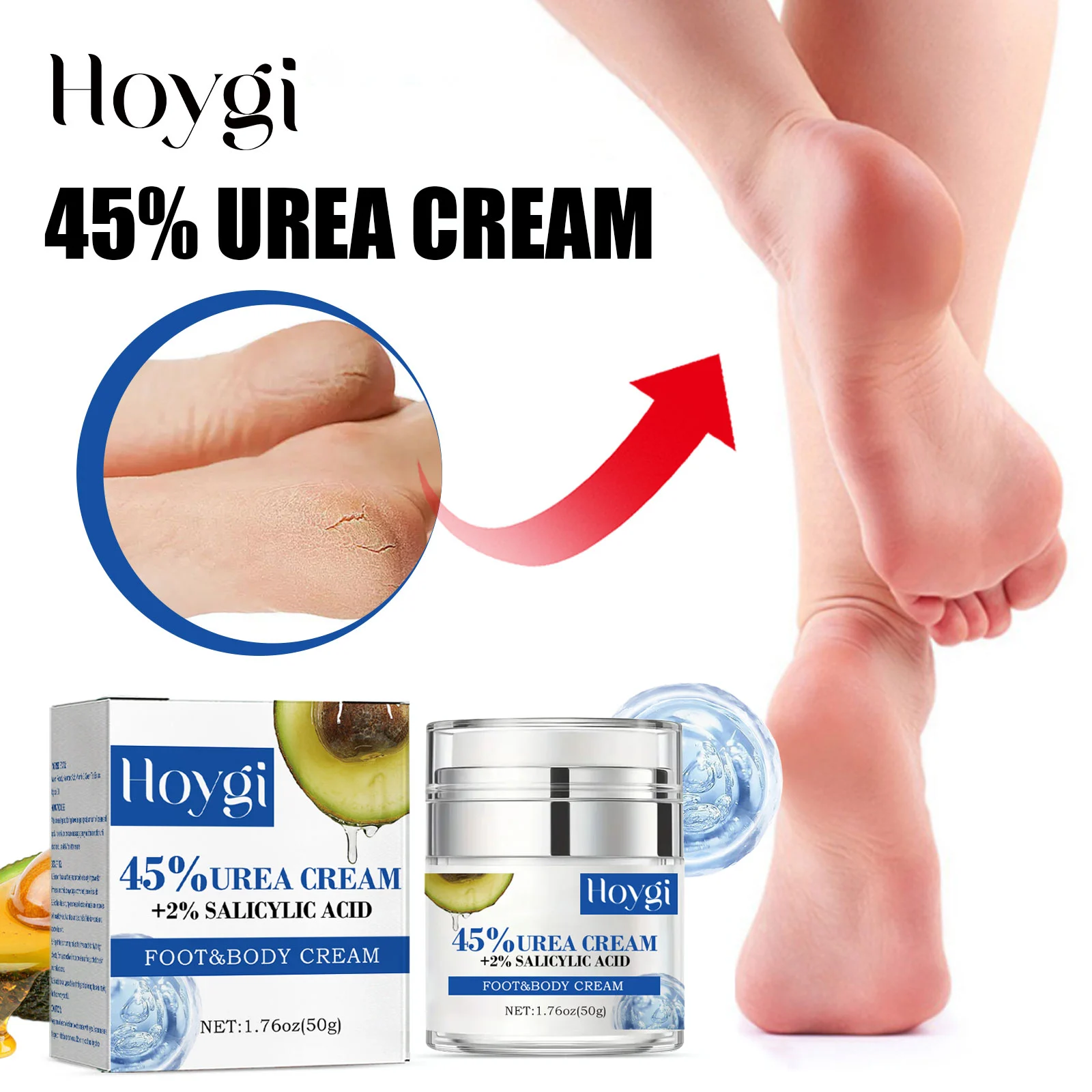 45% Urea Foot Cream 50g with 2% Salicylic Acid for Cracked Heels & Dry Skin Repair 2 45 urea foot cream 50g cracked heels repair cih af24uk8e desc 2