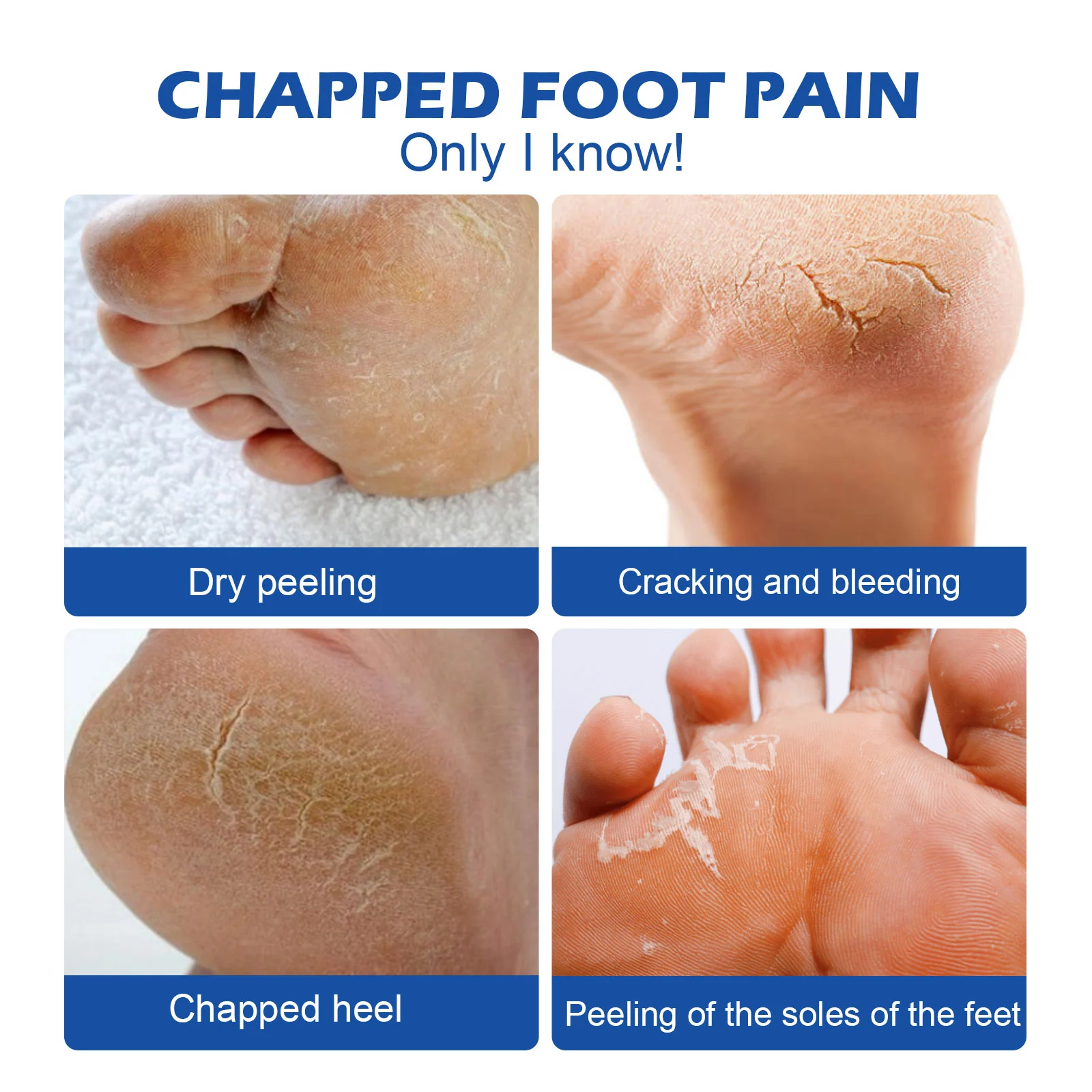 45% Urea Foot Cream 50g with 2% Salicylic Acid for Cracked Heels & Dry Skin Repair 6 45 urea foot cream 50g cracked heels repair cih af24uk8e desc 6
