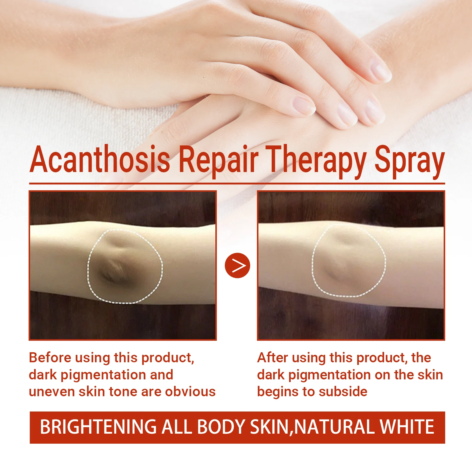 acanthosis nigricans repair therapy spray 30ml cih avj5ykuz desc 8