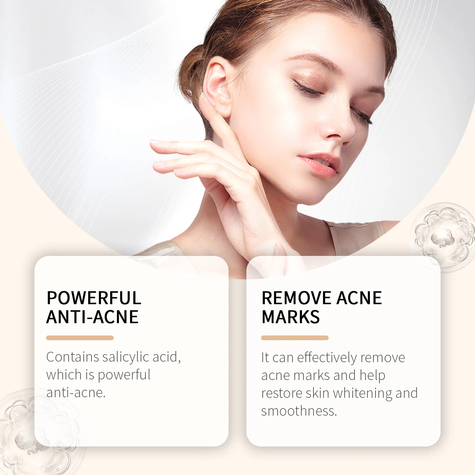 Acne Treatment Cream 50g with Salicylic Acid & Botanical Extracts for Soothing and Clearing Blemishes 8 acne treatment cream 50g salicylic acid der ypsaj4y2 desc 8