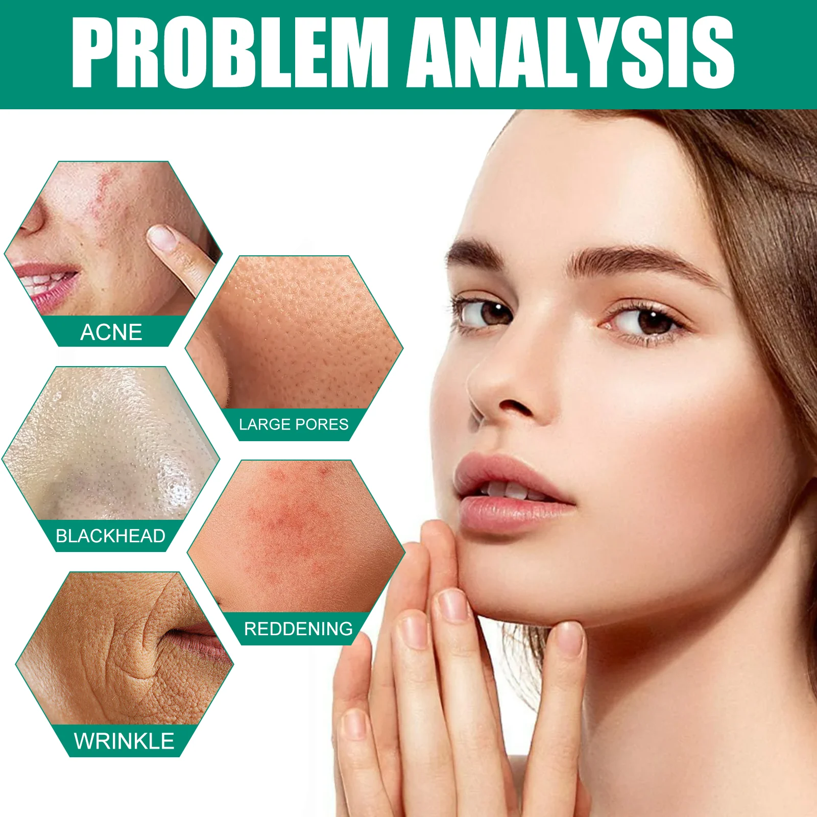 Hoygi AHA BHA Serum for Acne Pores Brightening Firming Skin 7 aha bha acid serum cih a97td35c desc 7