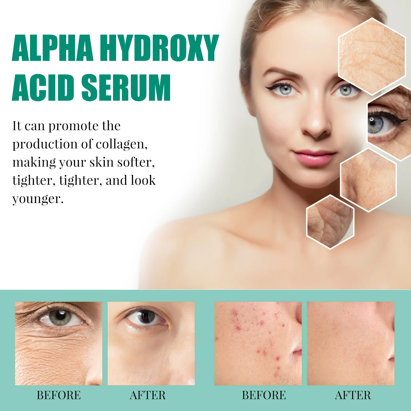 Hoygi AHA BHA Serum for Acne Pores Brightening Firming Skin 8 aha bha acid serum cih a97td35c desc 8