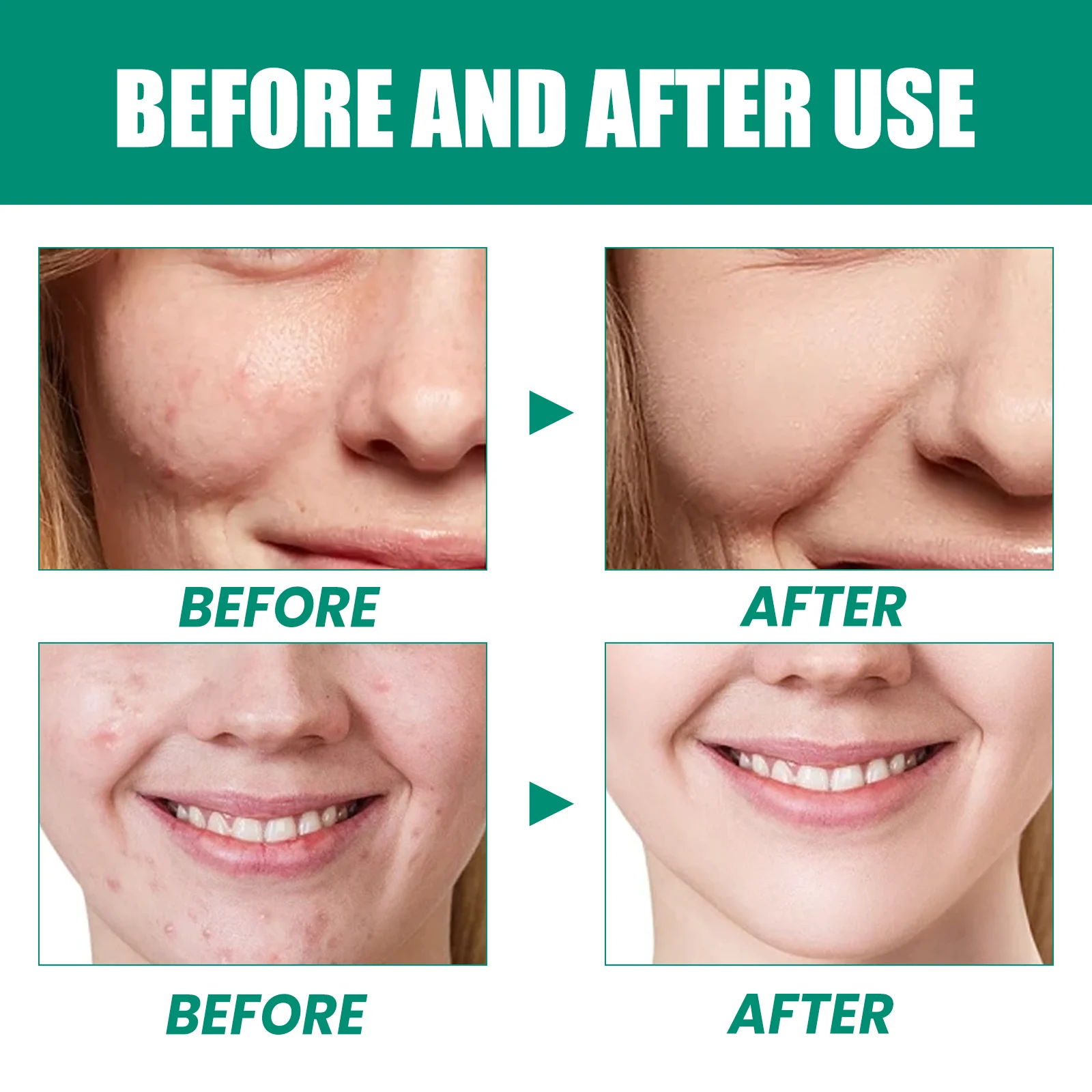 Hoygi AHA BHA Serum for Acne Pores Brightening Firming Skin 9 aha bha acid serum cih a97td35c desc 9