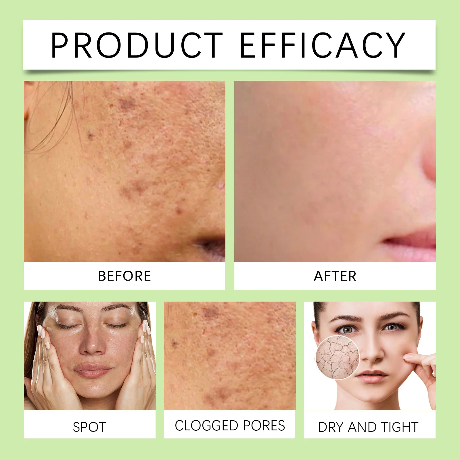 Aloe Cucumber Gel 100g Hydrating Soothing Moisturizer for Face and Body 9 aloe cucumber gel 100g hydrating soothing moisturizer cih 5naf9xm2 desc 9