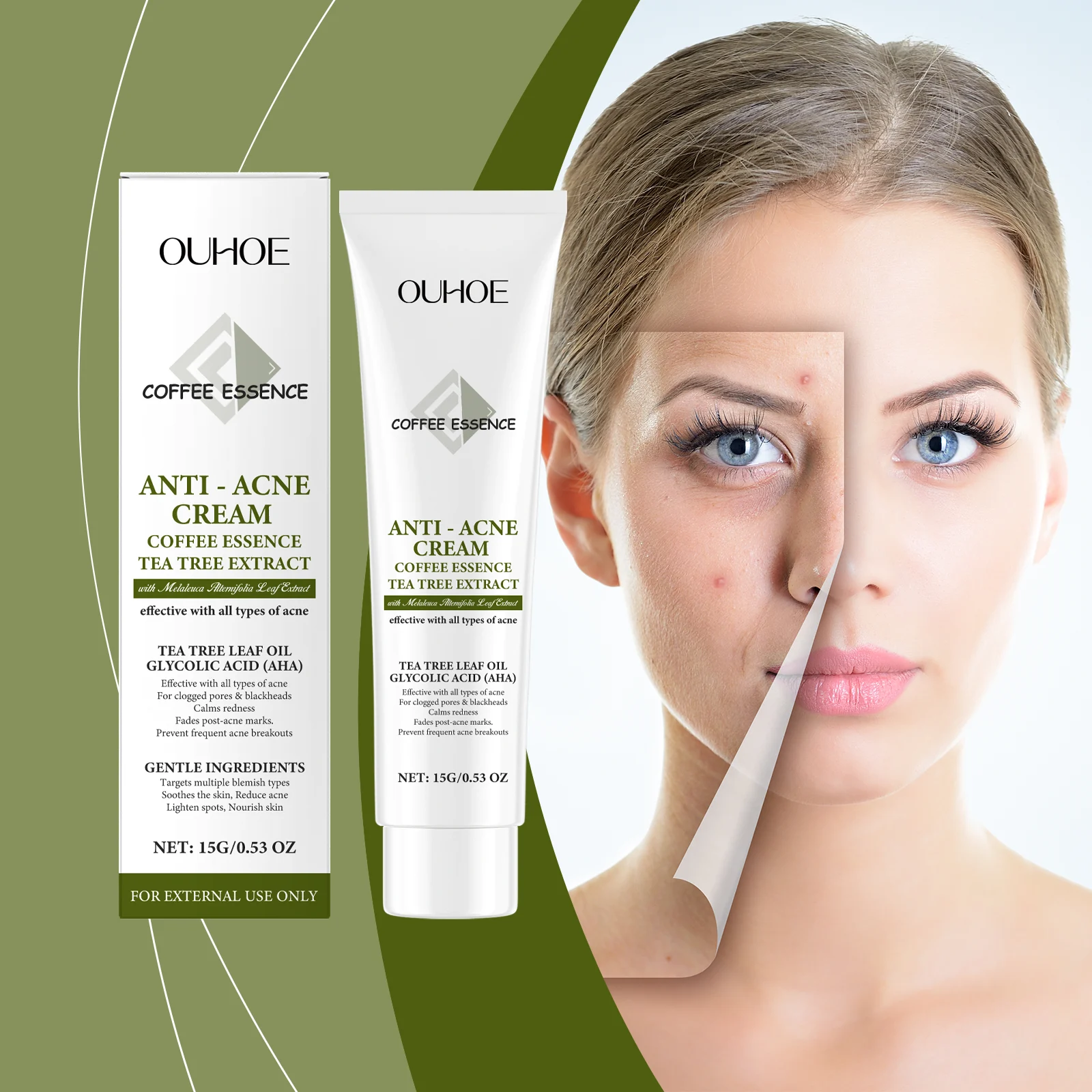 Anti-Acne Cream for Blemish-Prone Skin 15g with Tea Tree & Glycolic Acid 2 anti acne cream 15g tea tree glycolic acid der w9t8y3wr desc 2