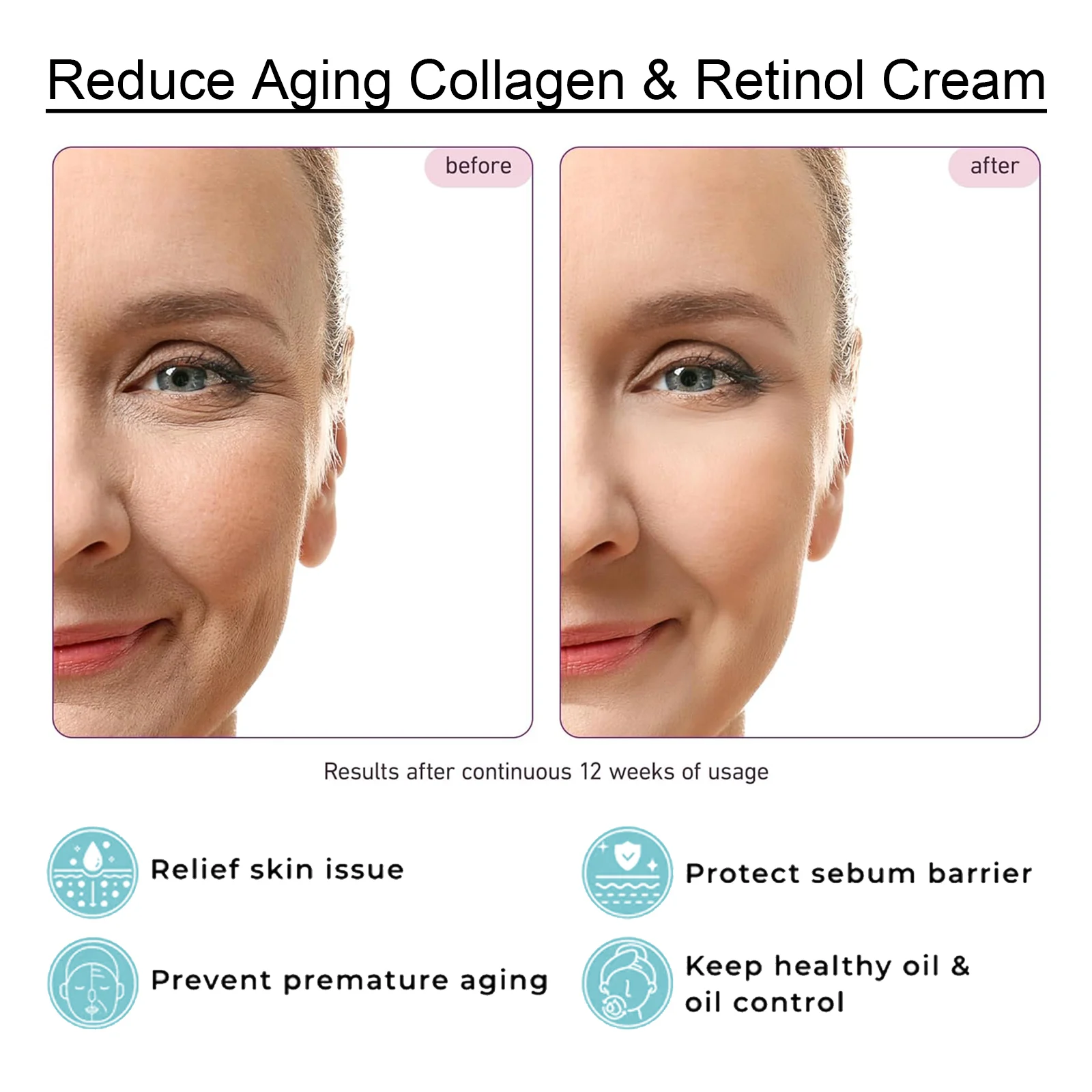 Hoygi Collagen & Retinol Cream Anti-Aging Moisturizer With Hyaluronic Acid & Vitamins 6 anti aging collagen retinol cream cih 6daujktq desc 6