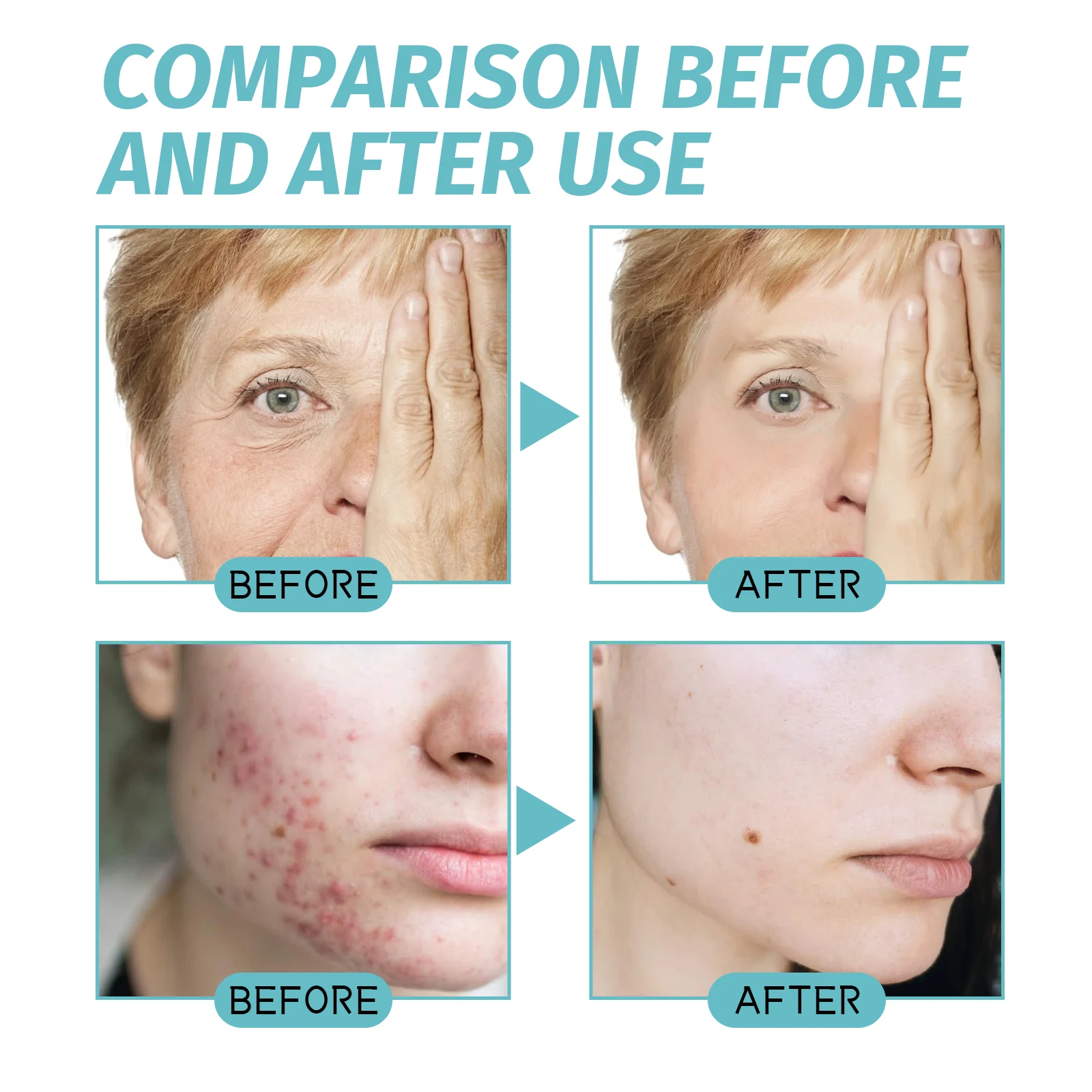 Hoygi Collagen & Retinol Cream Anti-Aging Moisturizer With Hyaluronic Acid & Vitamins 9 anti aging collagen retinol cream cih 6daujktq desc 9