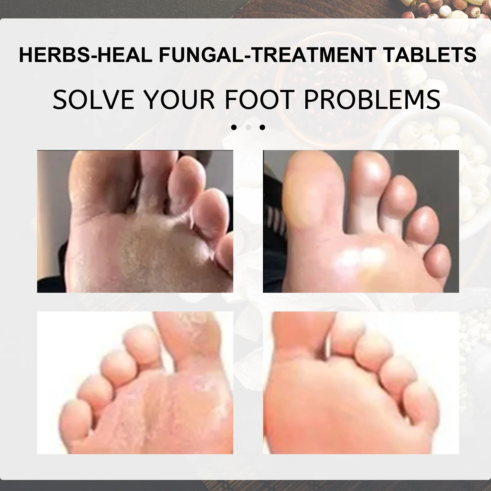 Anti-Fungal Peeling Foot Soak Tablets with Ginger for Exfoliation & Nail Care 9 anti fungal peeling foot soak tablets 10pcs cih tfnaytac desc 9
