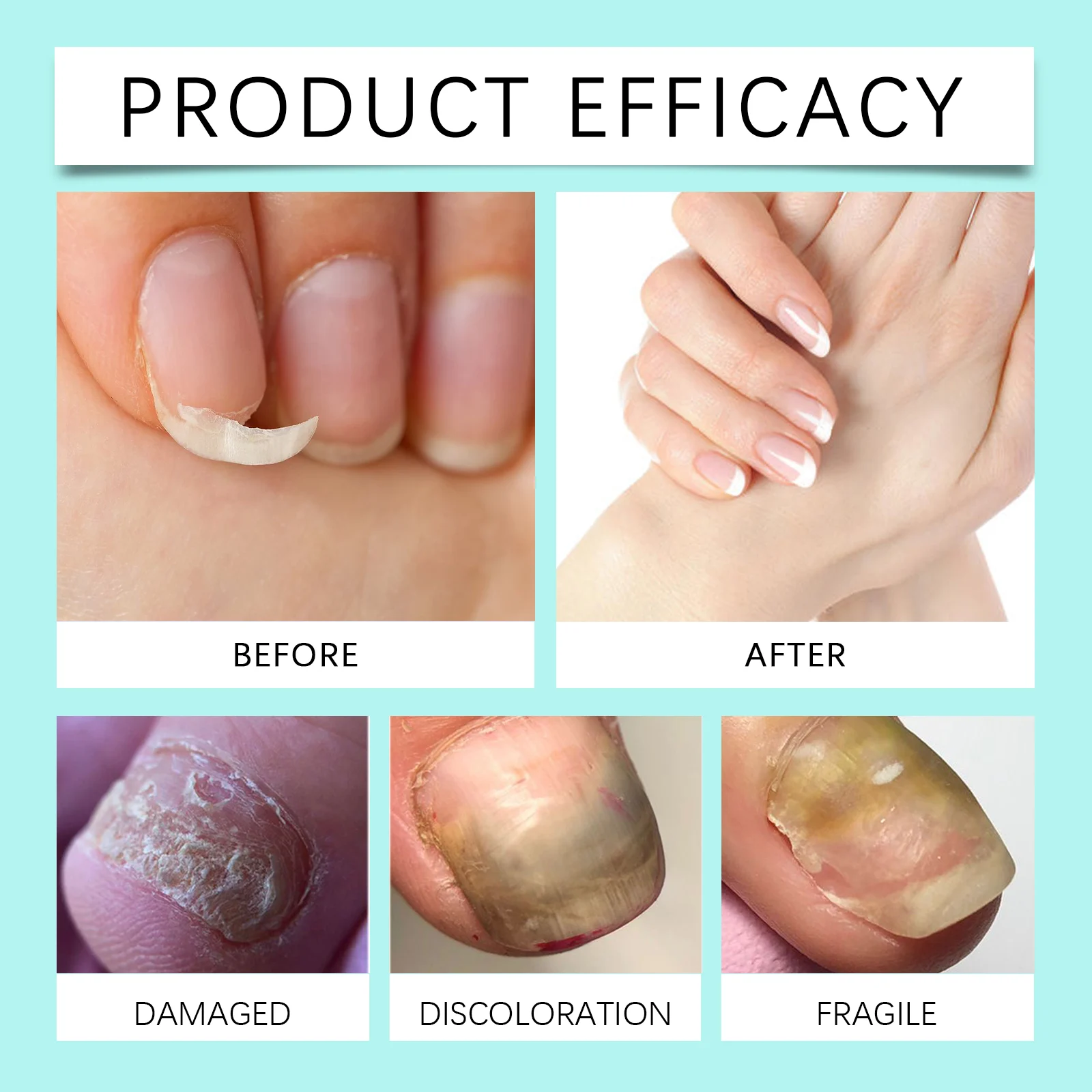 OceAura Anti Fungus Nail Care Liquid, Moisturizing & Repairing Nail Treatment Oil 9 anti fungus nail care liquid cih tyuqv6pt desc 9