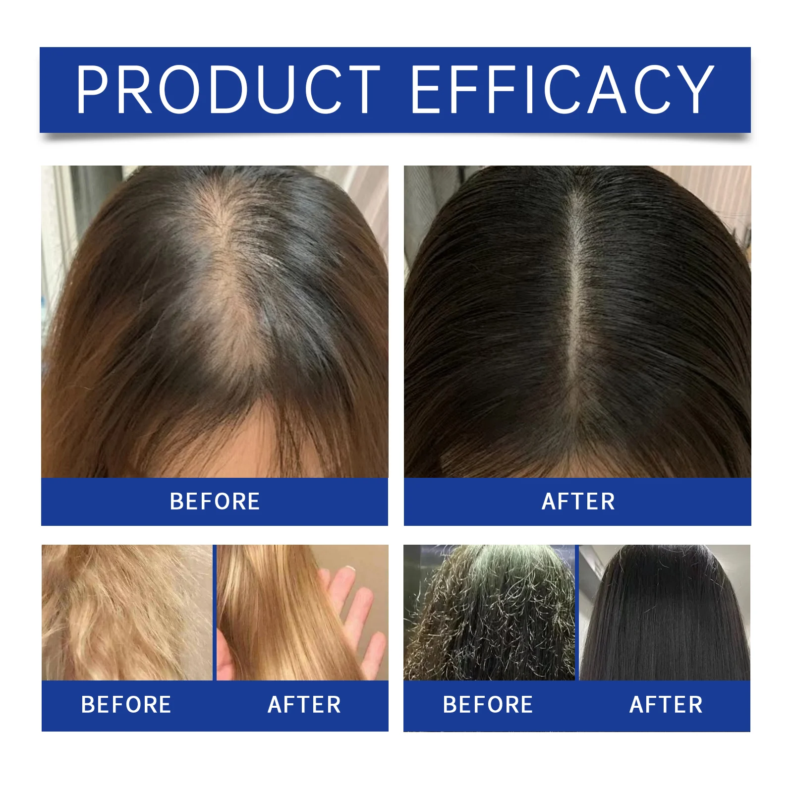 Anti Hair Loss Shampoo Strengthens Roots & Reduces Breakage 100ml 9 anti hair loss shampoo 100ml cih m4gpqdtu desc 9