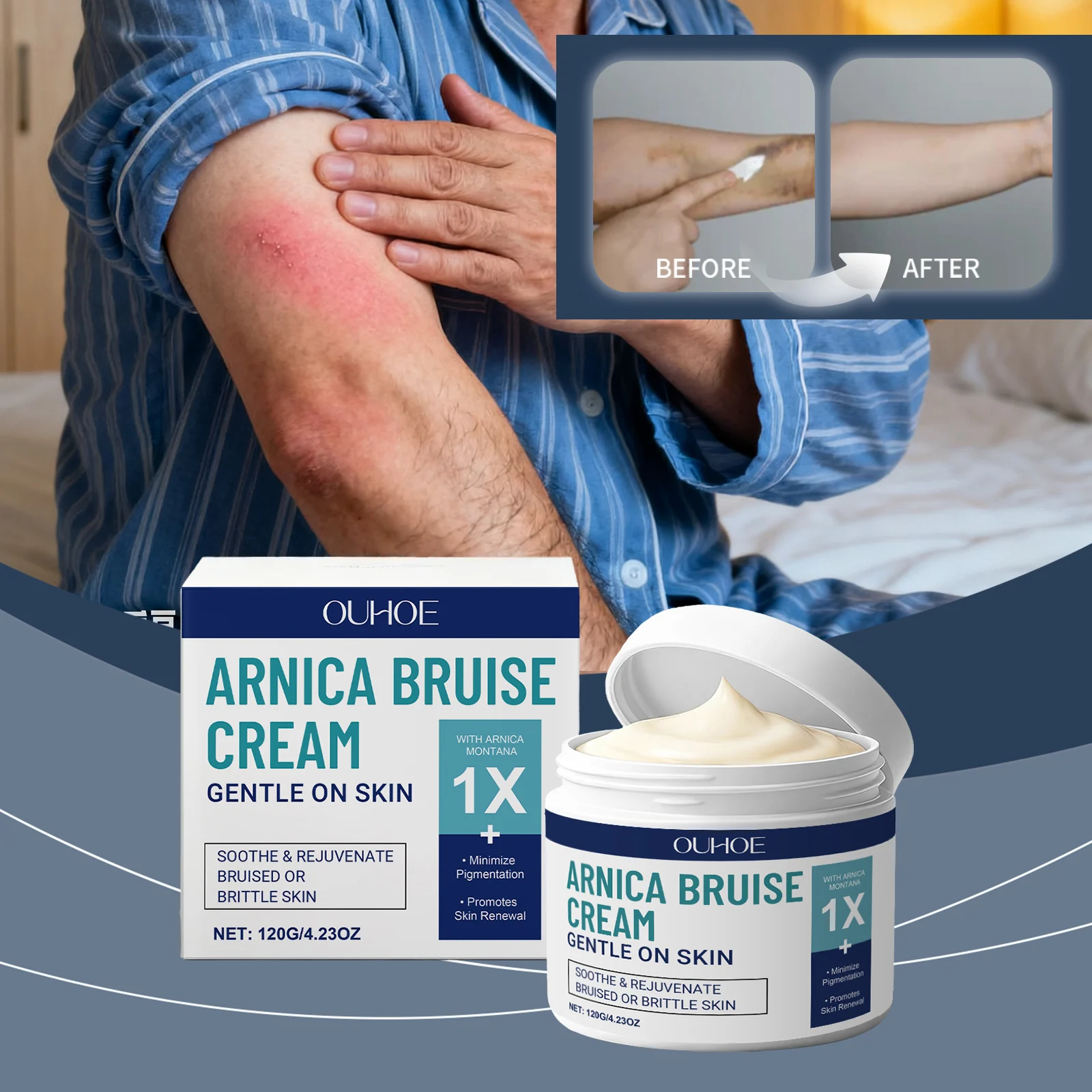 Arnica Bruise Cream 120g for Sensitive Skin, Soothes & Reduces Bruising & Swelling 2 arnica bruise cream 120g sensitive skin der cp6r3cyp desc 2