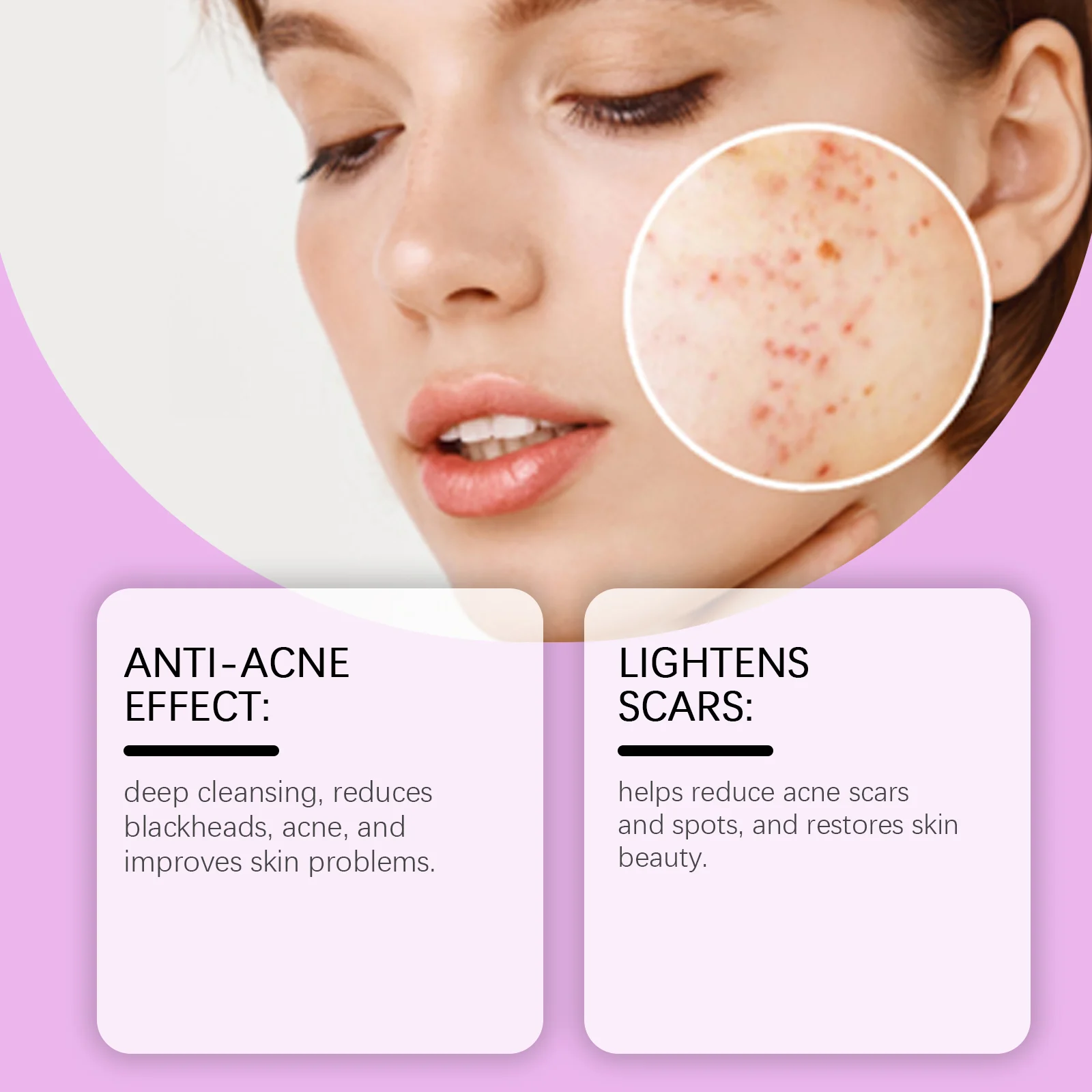 OUHOE 12% Azelaic Acid Acne Repair Cream for Face, Reduces Acne, Scars & Discoloration 7 azelaic acid acne repair cream der ndruada5 desc 8