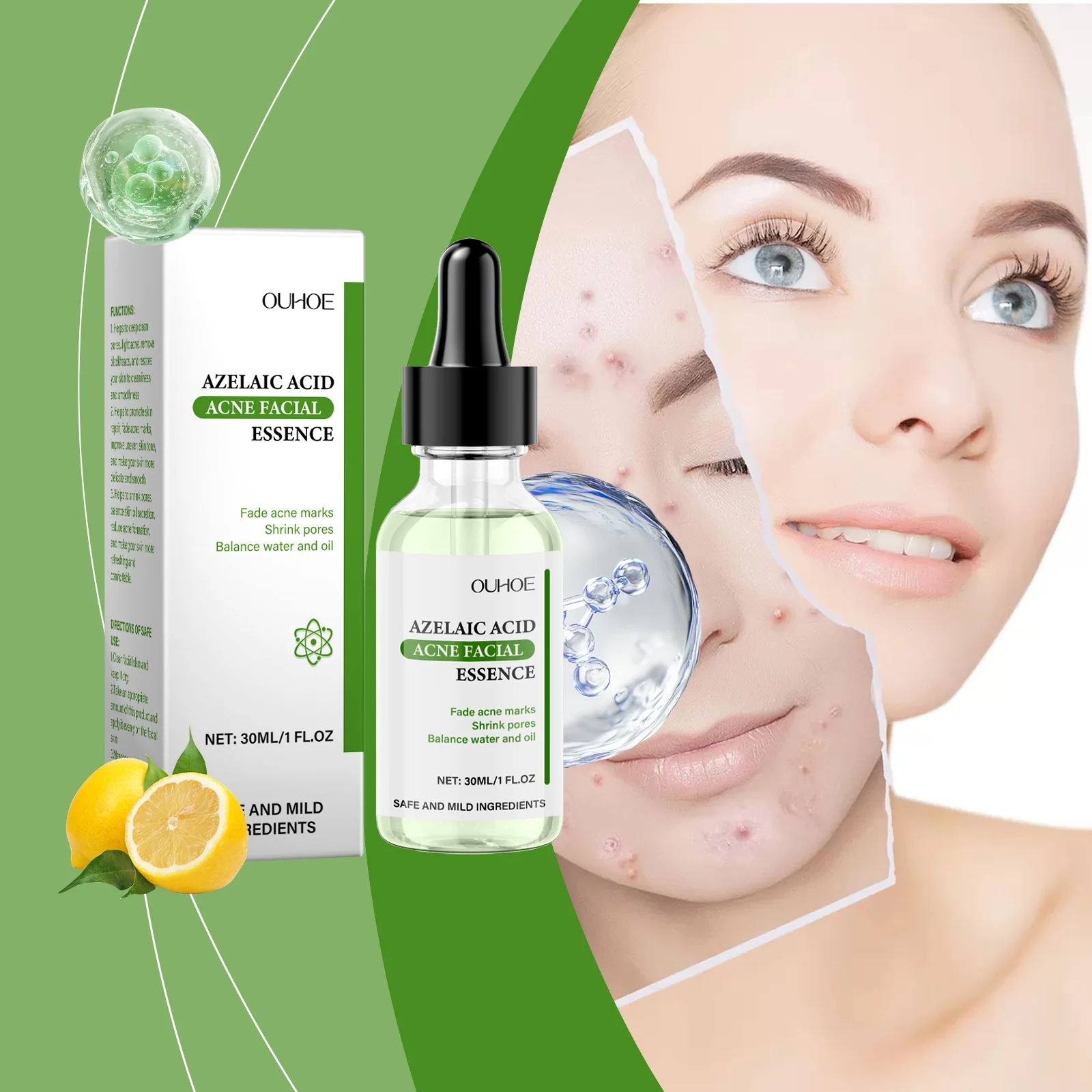 Azelaic Acid Acne Treatment Serum 30ml for Pore Minimizing & Scar Fading 2 azelaic acid acne treatment serum 30ml cih hvh92afr desc 2