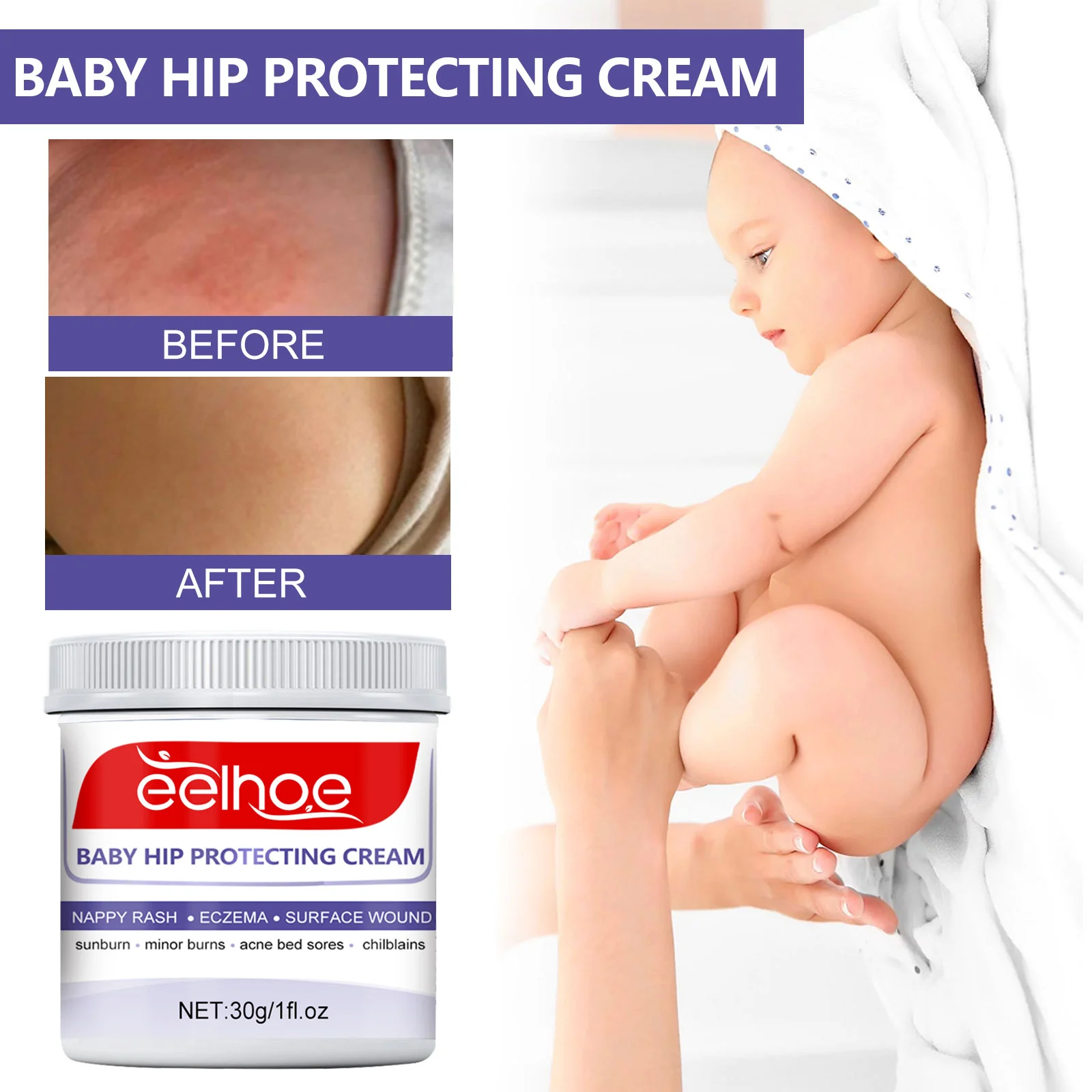 Baby Diaper Rash Cream Soothing Redness and Moisturizing Skin for Infants 30g 9 baby diaper rash cream 30g cih esw63xt7 desc 9