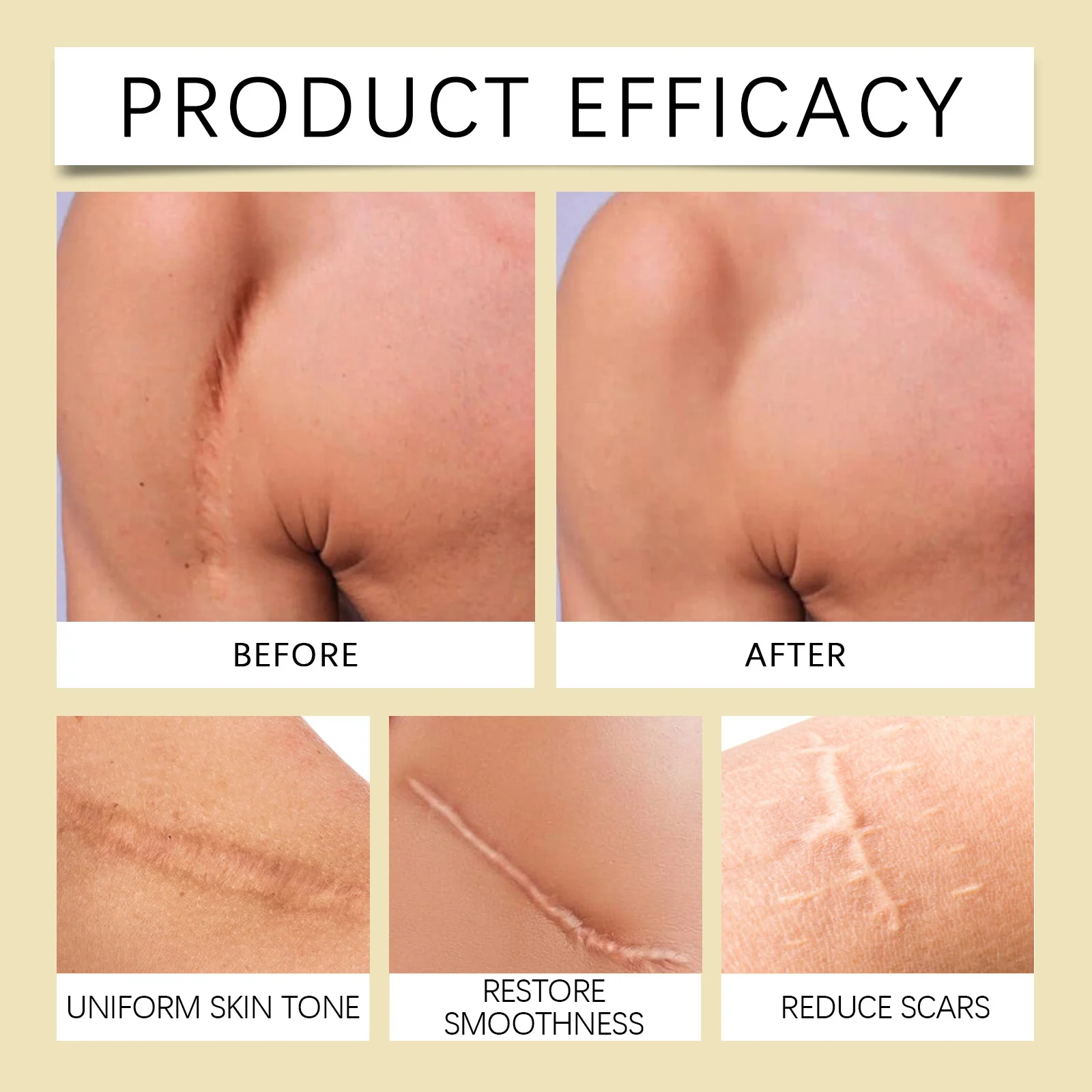 Bee Venom Body Care Gel 30g for Scar Removal & Skin Repair with Garlic & Centella 9 bee venom body care gel 30g scar removal cih 8trbxfkj desc 9