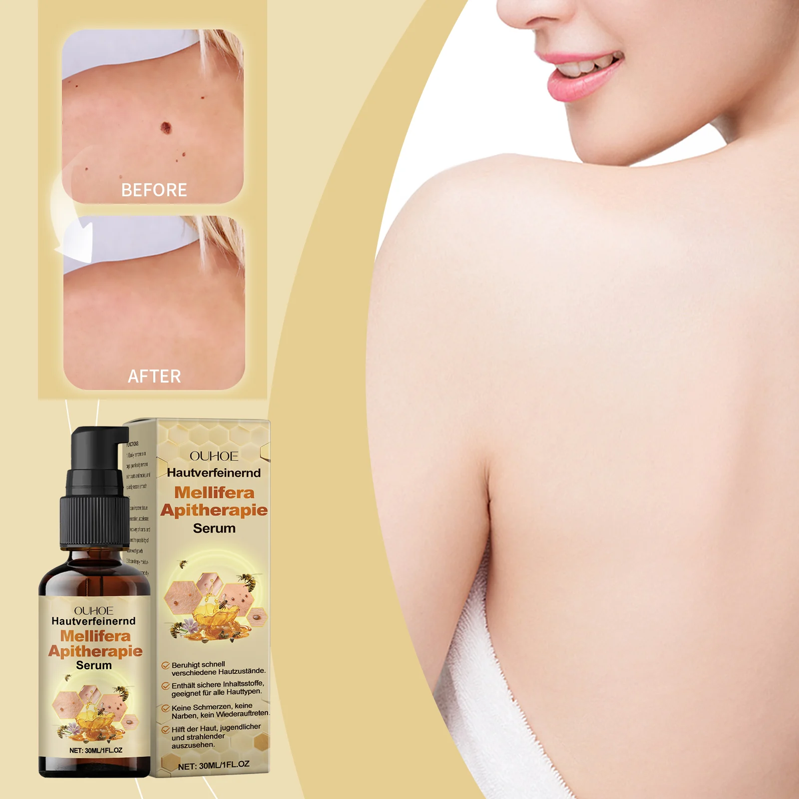 Bee Venom Skin Serum for Wart & Mole Removal, 30ml, Nourishing with Tallow & Glycerin 2 bee venom skin serum wart mole removal 30ml cih bbf2dwje desc 2