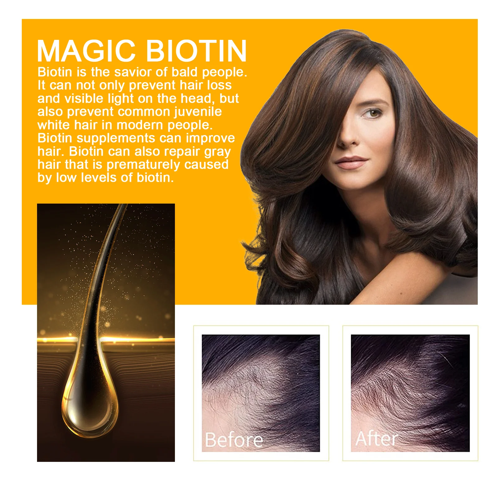Biotin Hair Growth Serum Spray for Hair Loss Treatment and Repair 5 biotin hair growth serum spray 30ml cih 2hkvepnm desc 5