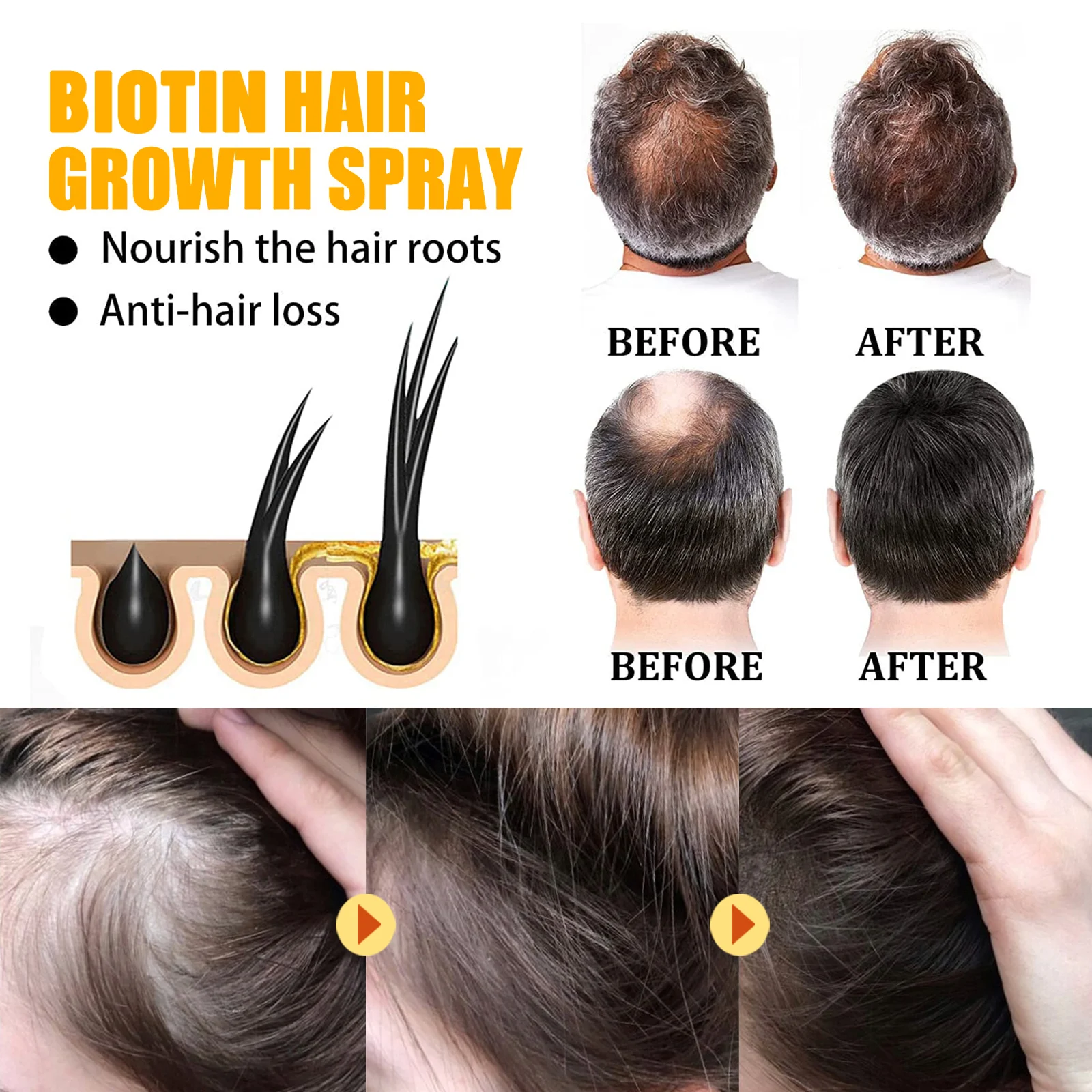Biotin Hair Growth Serum Spray for Hair Loss Treatment and Repair 6 biotin hair growth serum spray 30ml cih 2hkvepnm desc 6