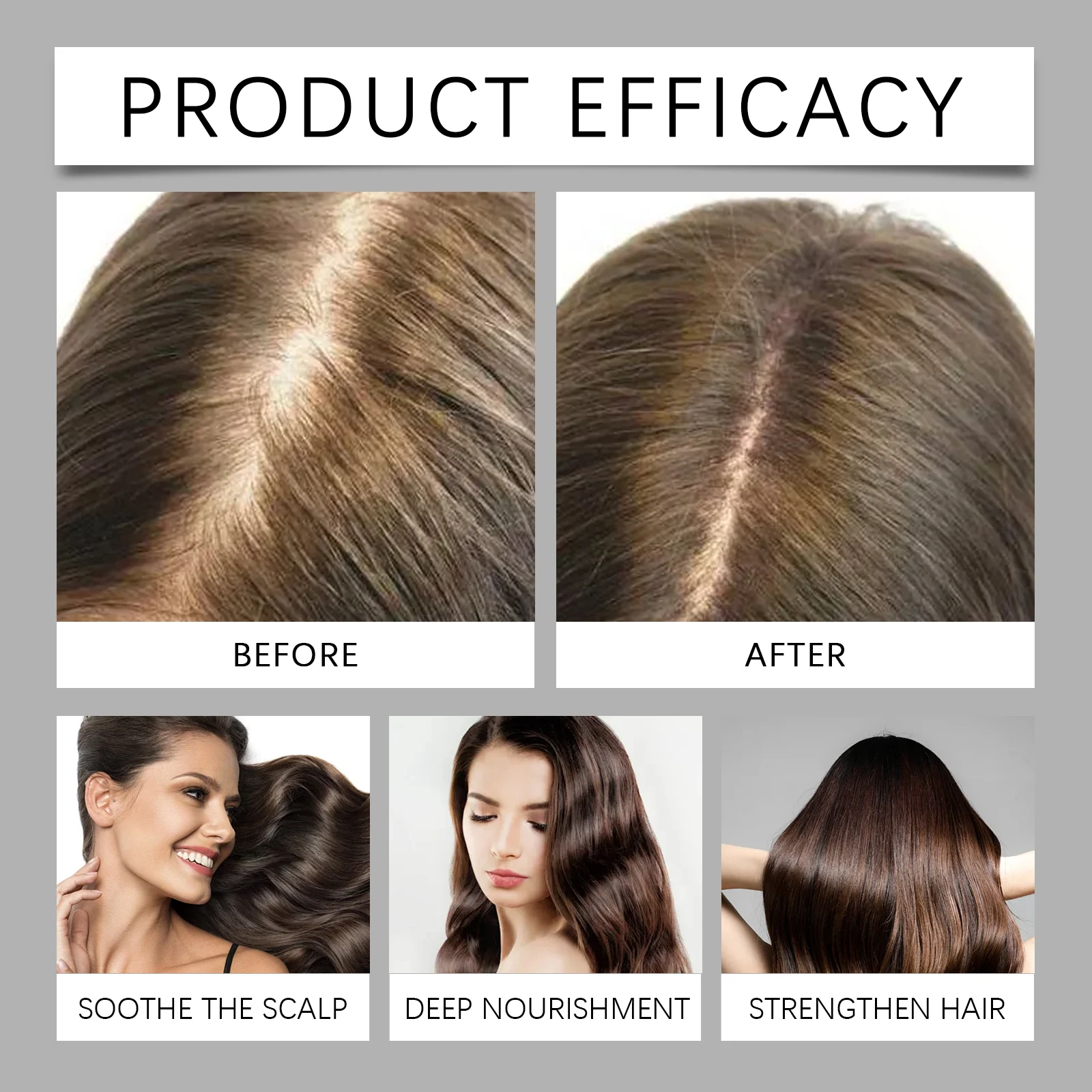 Black Castor Oil Hair Treatment Serum 60ml Nourish Scalp Strengthen Roots Reduce Hair Loss 12 black castor oil hair treatment serum 60ml der b7rcp6mt desc 12