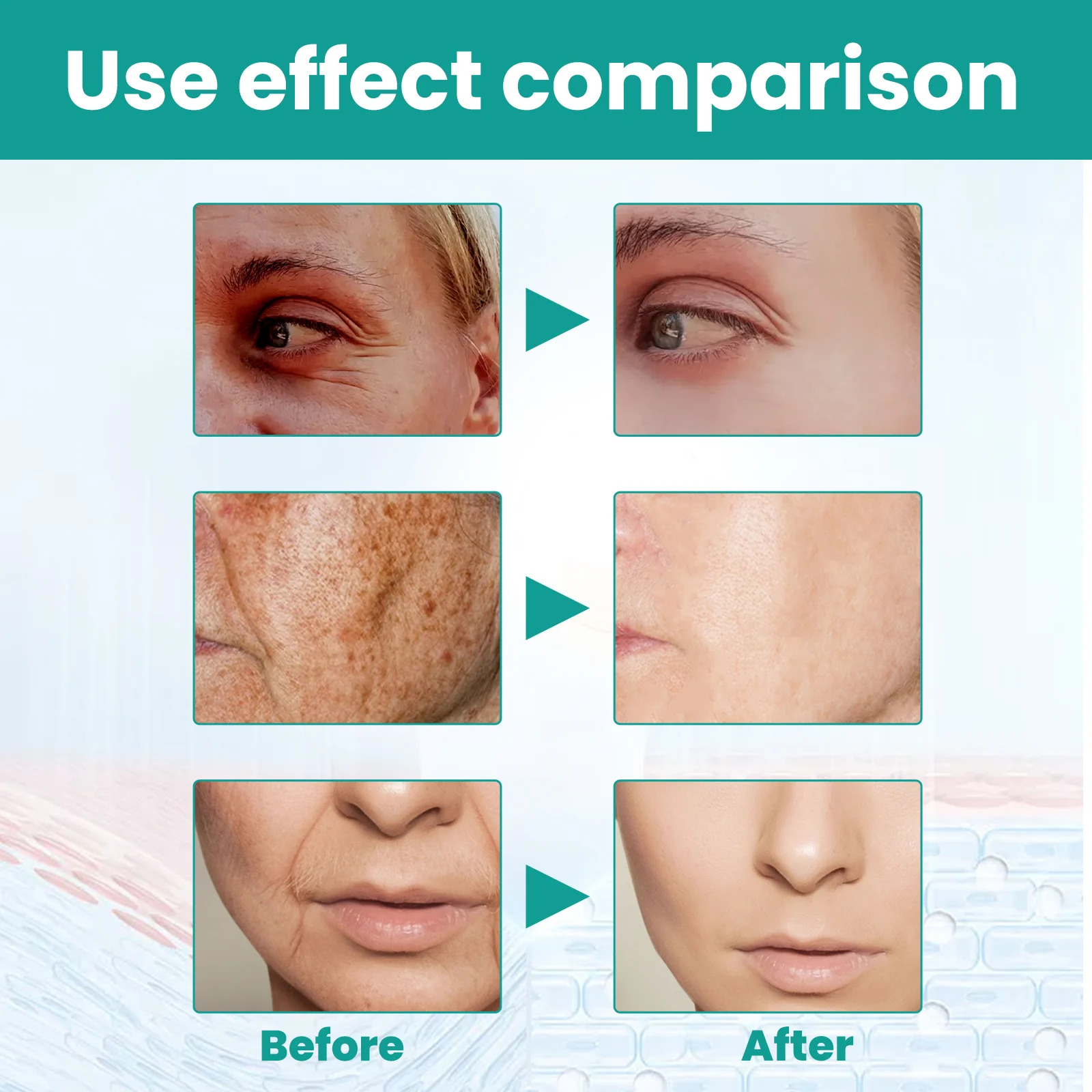 Black Spot Anti-Aging Serum 30ml, Fades Dark Spots & Fine Lines, Deeply Moisturizes & Firms Skin 10 black spot anti aging serum 30ml cih 7kf9jdug desc 10