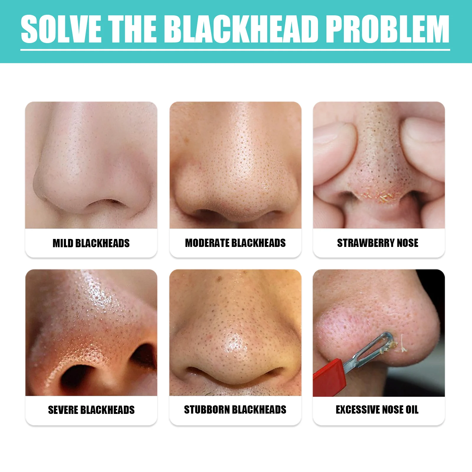 Blackhead Nose Mask Serum 30ml for Deep Pore Cleansing and Blackhead Removal 5 blackhead nose mask serum 30ml cih hcbjcp83 desc 5