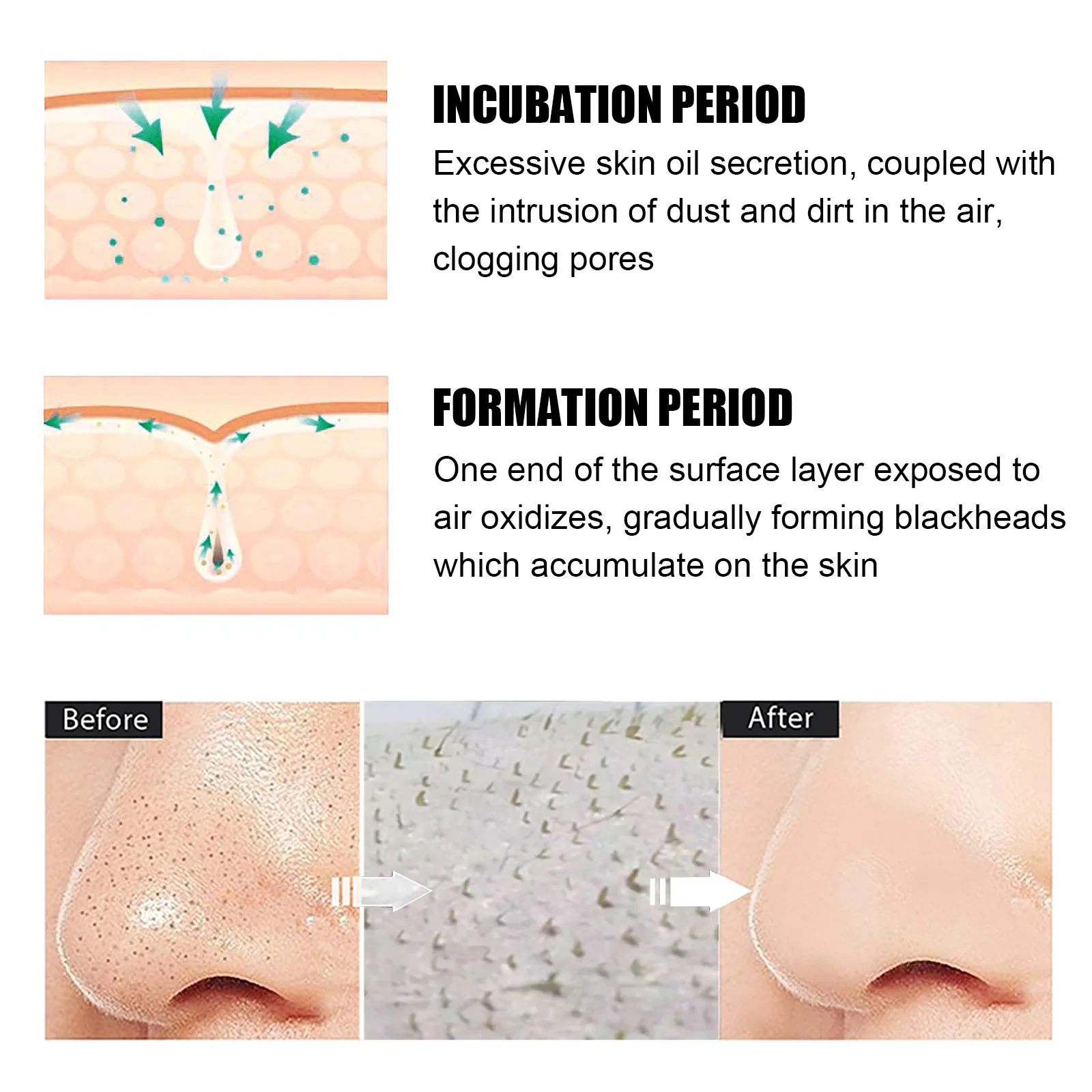 Blackhead Peel Off Nose Mask Deep Cleansing Pore Minimizer for Blackheads & Whiteheads 6 blackhead peel off nose mask 15g with 40pads cih bk8v3yx6 desc 6