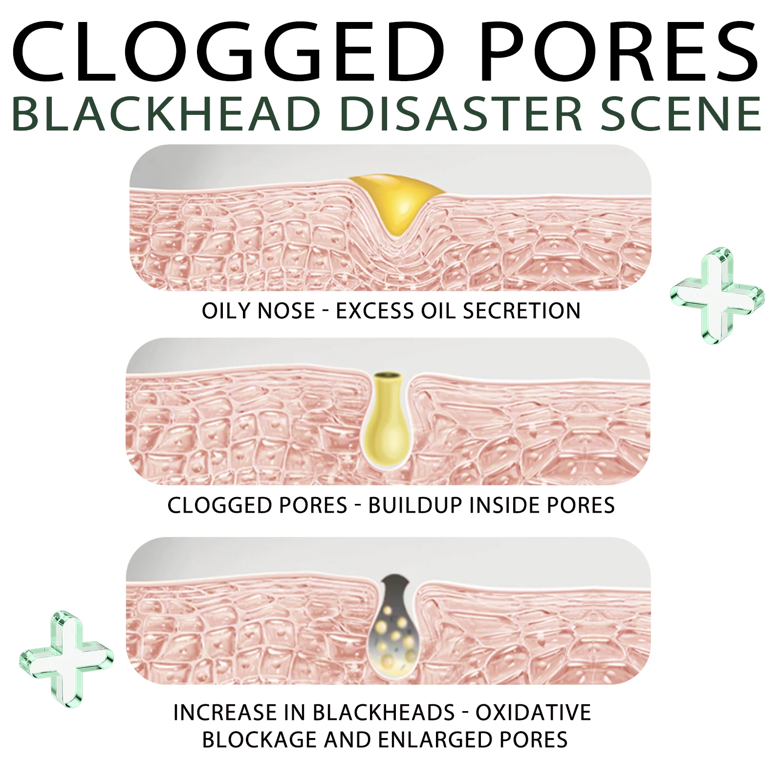 Blackhead Peel Off Nose Mask Deep Cleansing Pore Minimizer for Blackheads & Whiteheads 8 blackhead peel off nose mask 15g with 40pads cih bk8v3yx6 desc 8