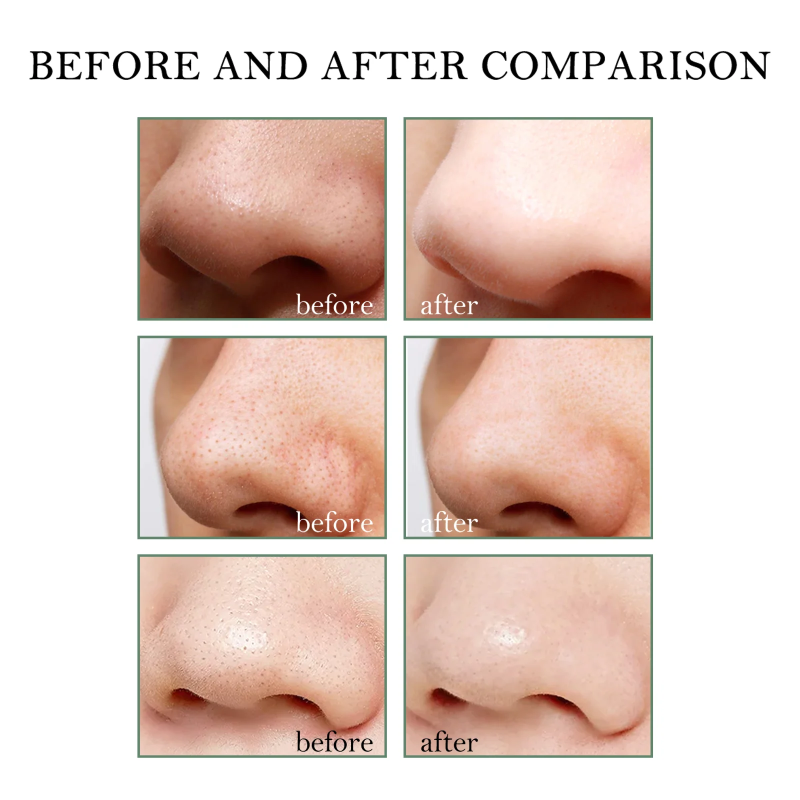 Blackhead Peel Off Nose Mask Deep Cleansing Pore Minimizer for Blackheads & Whiteheads 9 blackhead peel off nose mask 15g with 40pads cih bk8v3yx6 desc 9