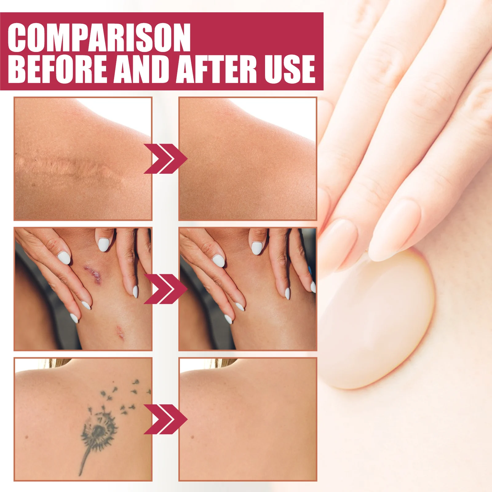 Body Makeup Foundation 100ml - Full Coverage Waterproof Concealer for Scars, Tattoos & Blemishes 10 body makeup foundation 100ml full coverage waterproof concealer cih 7rcdadvx desc 10