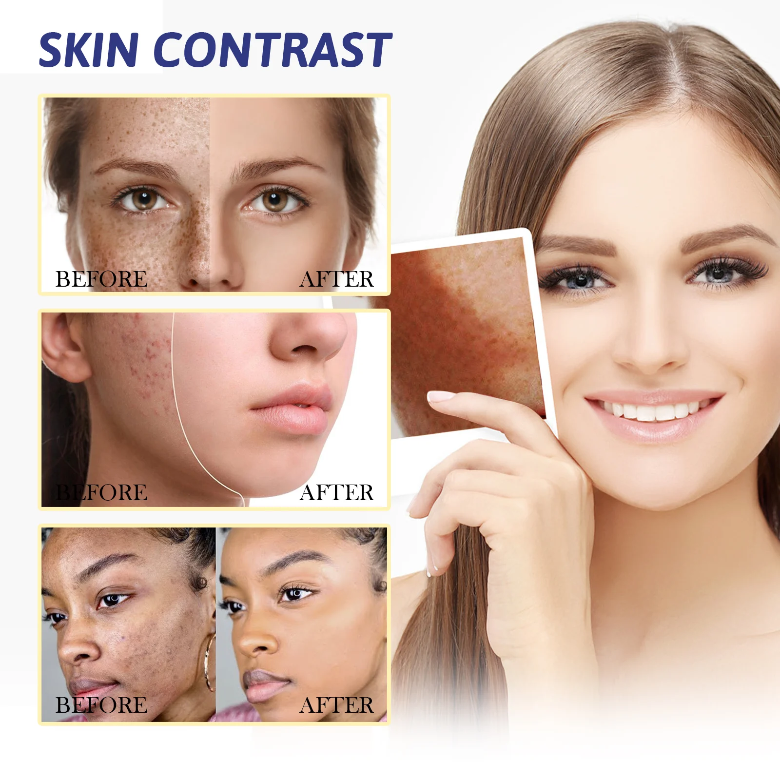 Brightening Cream for Dark Spots 30g, Whitening & Hydrating Face Cream to Improve Dullness 8 brightening cream dark spots whitening hydrating 30g cih 9srxb8ya desc 8