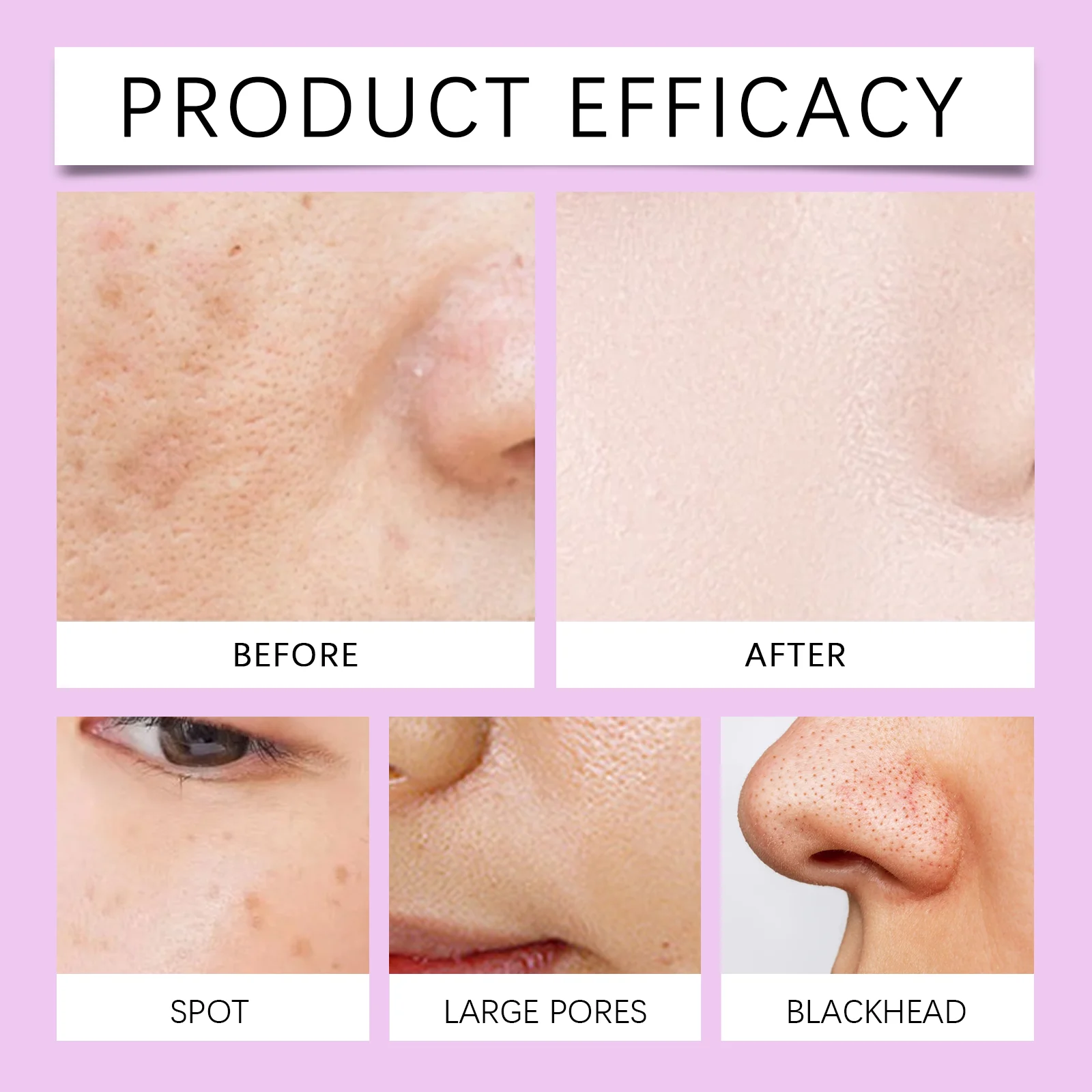 Brightening Essence for Face with Tranexamic Acid & Niacinamide 30ml 10 brightening essence tranexamic acid niacinamide 30ml cih tj6qgzgm desc 10
