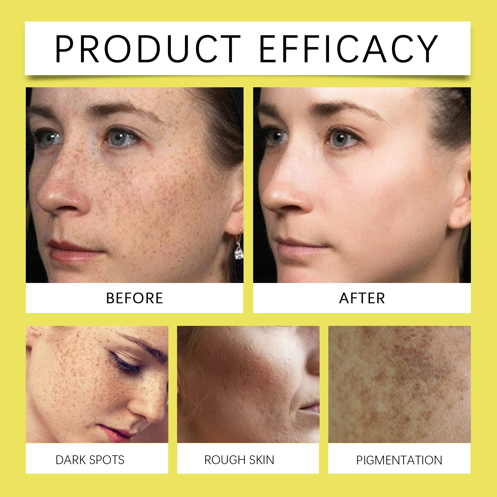 Brightening Skin Soap with Kojic Acid & Tranexamic Acid, Moisturizing Dark Spot Treatment Bar 100g 11 brightening skin soap kojic acid tranexamic acid dark spot bar 100g cih k45kf9bn desc 11