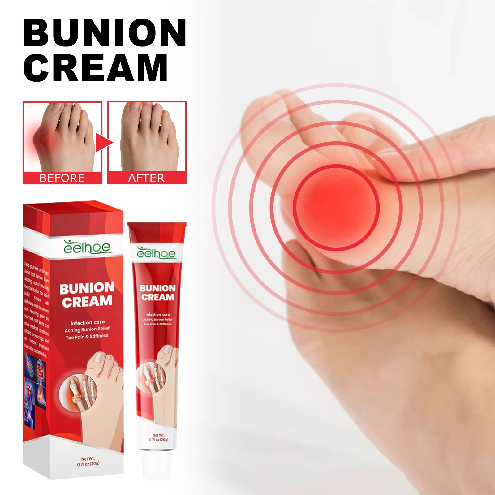 Bunion Cream for Pain Relief, Toe Alignment & Foot Care 20g 2 bunion cream toe alignment pain relief 20g cih fgfphyaq desc 2