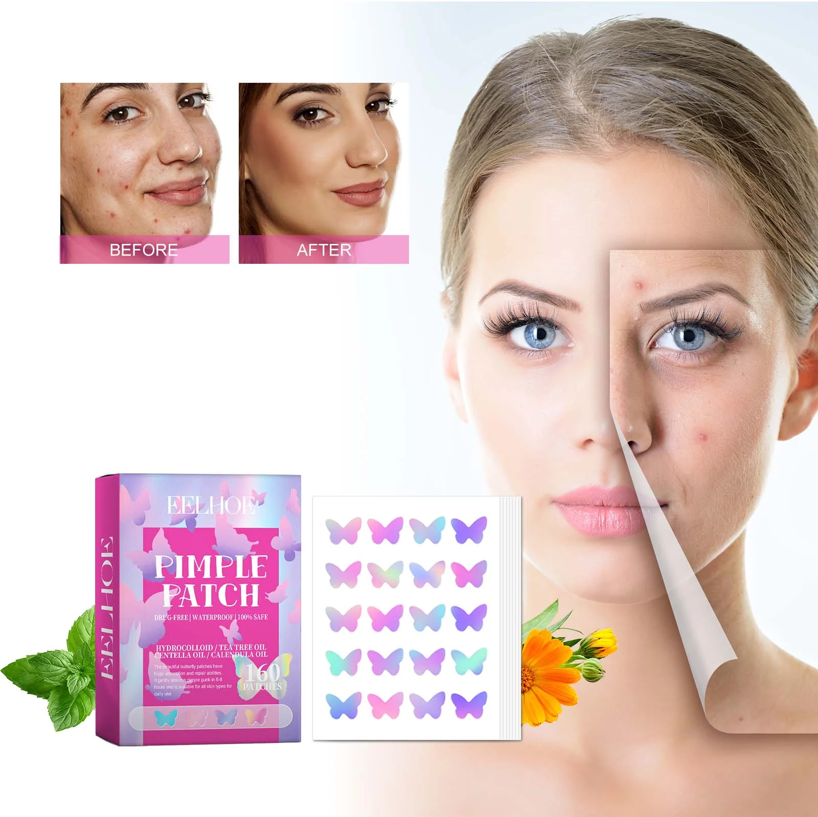 Butterfly Acne Patches 160 Patches Hydrocolloid Acne Spot Treatment 2 butterfly acne patches hydrocolloid 160 patches cih vn6gxh7a desc 2