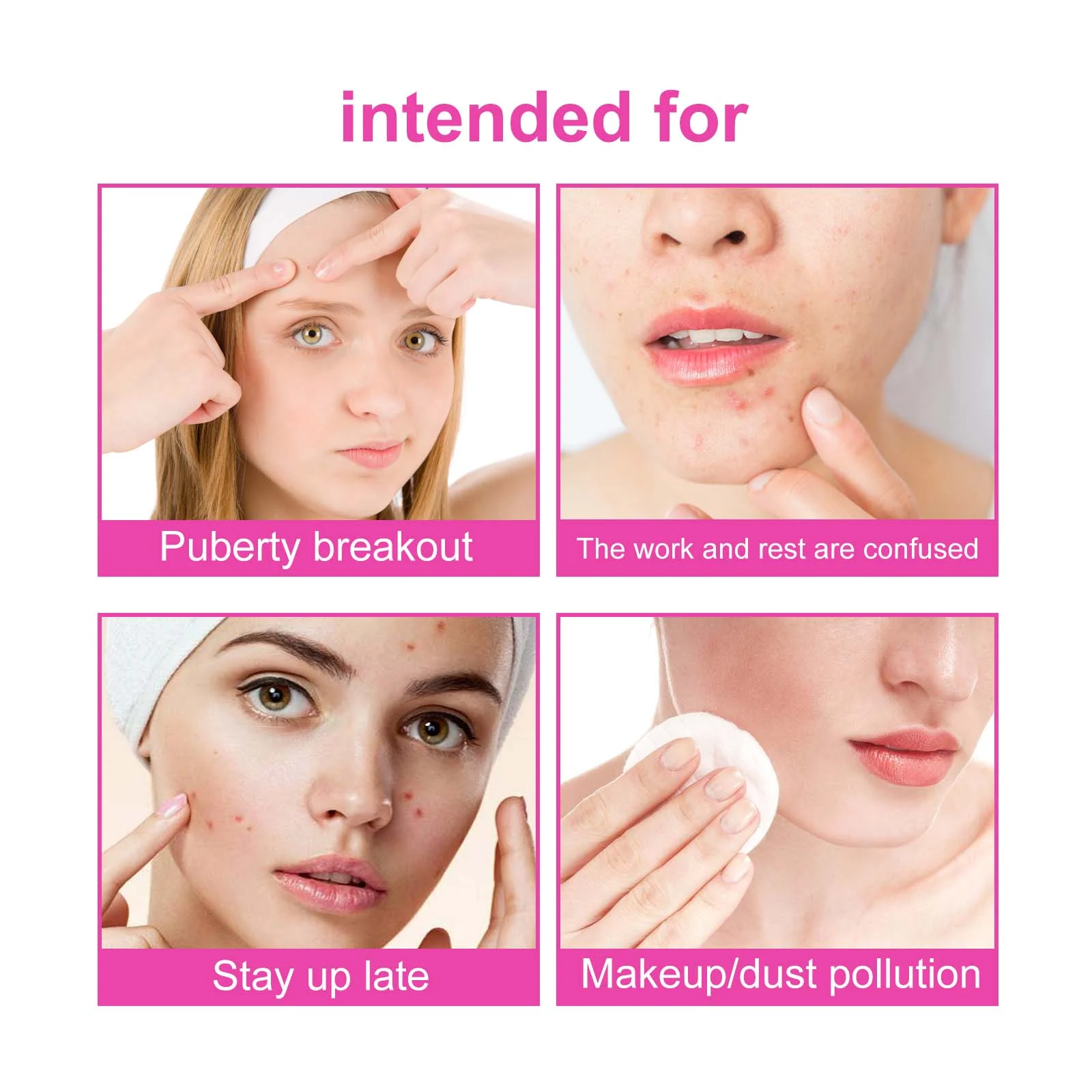 Butterfly Acne Patches 160 Patches Hydrocolloid Acne Spot Treatment 7 butterfly acne patches hydrocolloid 160 patches cih vn6gxh7a desc 7