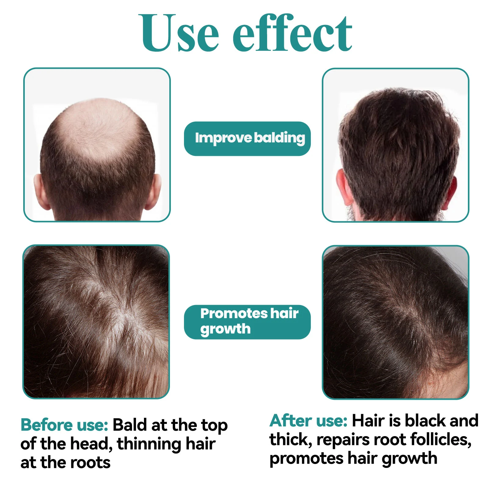 Hair Growth Serum Caffeine + Biotin Peptide Density Serum for Thinning Hair 45ml 10 caffeine biotin peptide hair growth serum 45ml cih hf5esz2z desc 10