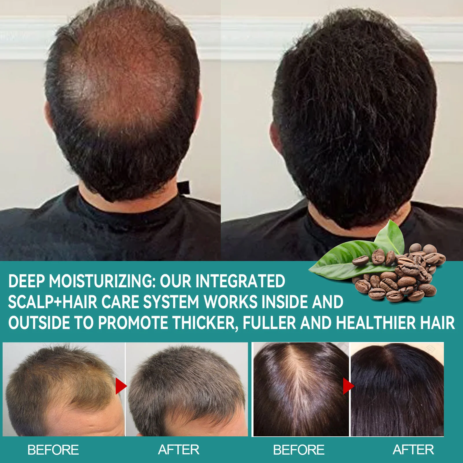 Hair Growth Serum Caffeine + Biotin Peptide Density Serum for Thinning Hair 45ml 8 caffeine biotin peptide hair growth serum 45ml cih hf5esz2z desc 8