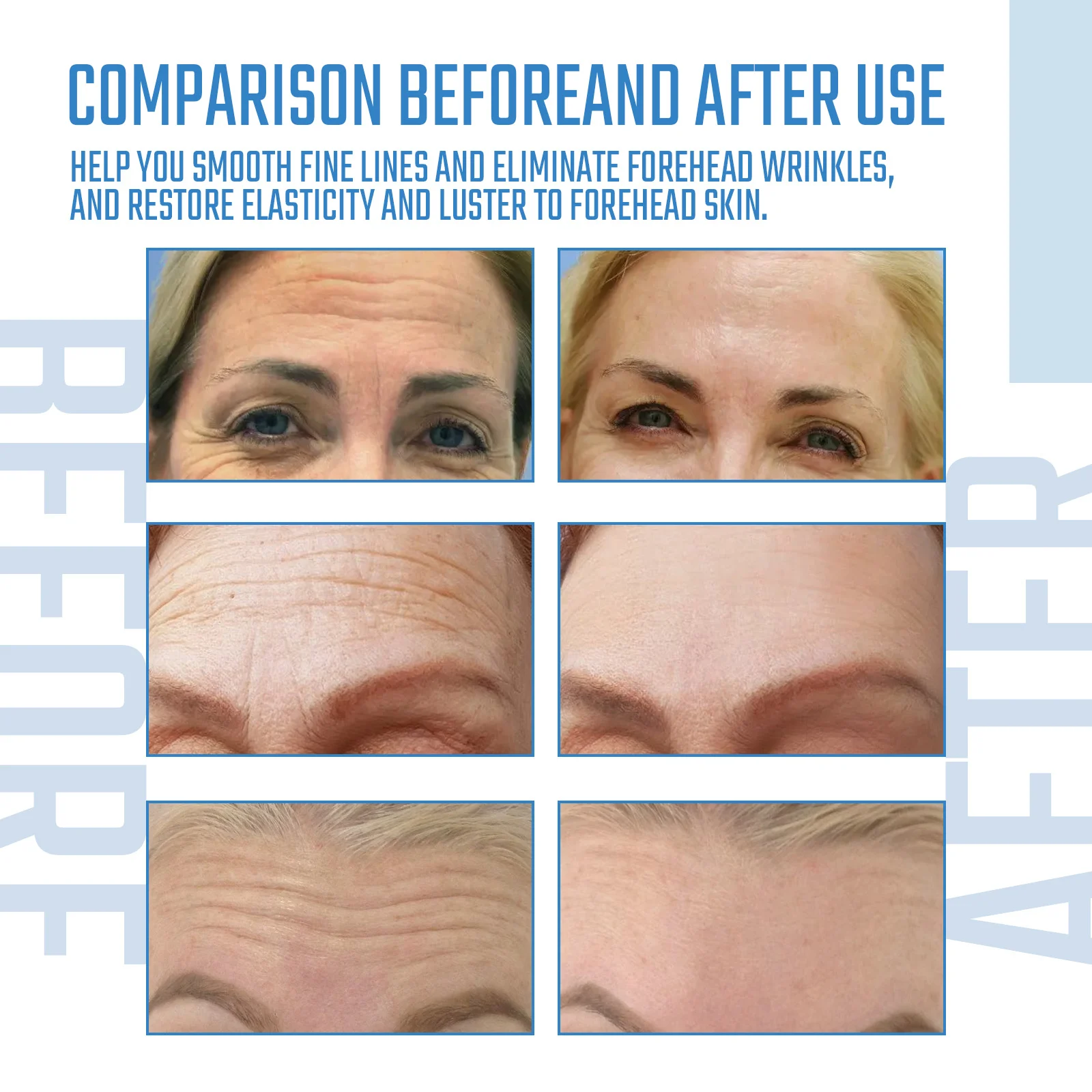 Collagen Forehead Mask 6 Packs (16*8cm) Hydrate & Smooth Fine Lines 8 collagen forehead mask 6 packs hydrate smooth fine lines cih c62c4jwy desc 8
