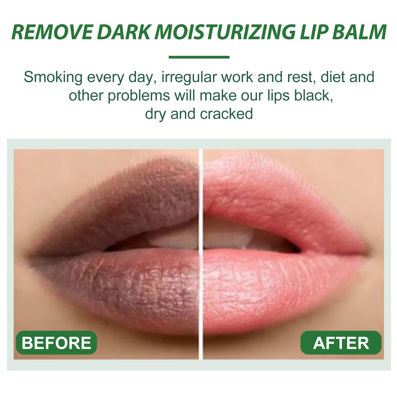 Dark Lip Balm Lip Lightening Treatment to Moisturize and Repair Chapped Lips 3g 4 dark lip balm lightening treatment 3g cih g4rsfpa8 desc 4