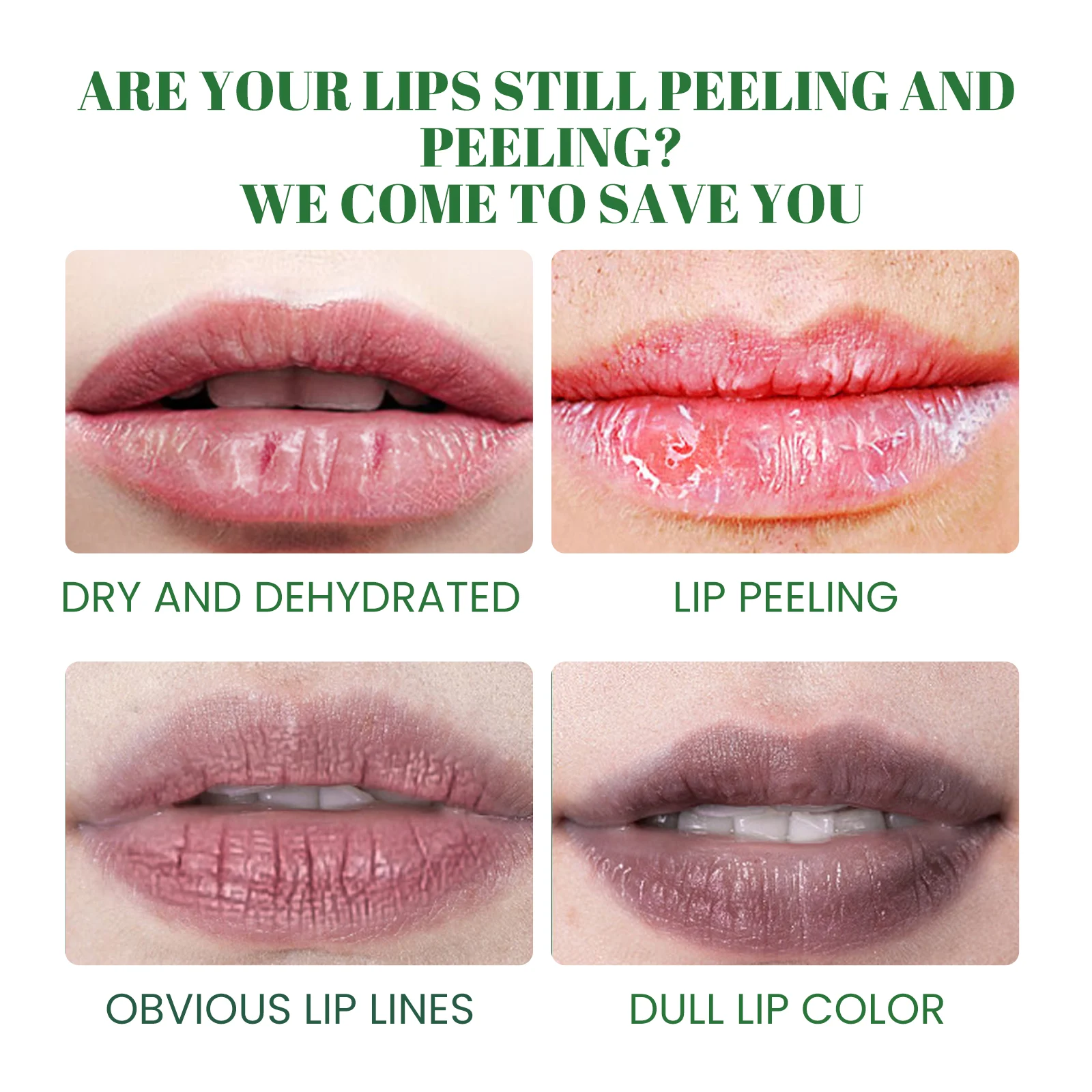 Dark Lip Balm Lip Lightening Treatment to Moisturize and Repair Chapped Lips 3g 5 dark lip balm lightening treatment 3g cih g4rsfpa8 desc 5
