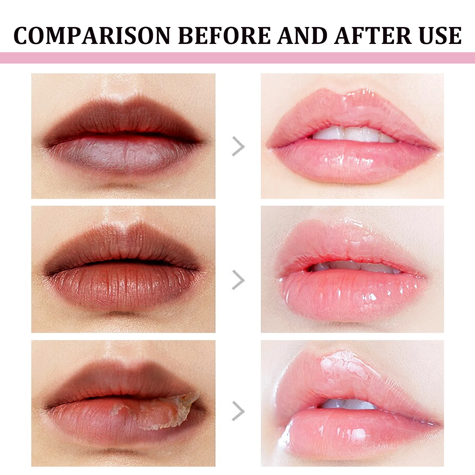 Dark Lip Balm Lip Lightening Treatment to Moisturize and Repair Chapped Lips 3g 8 dark lip balm lightening treatment 3g cih g4rsfpa8 desc 8