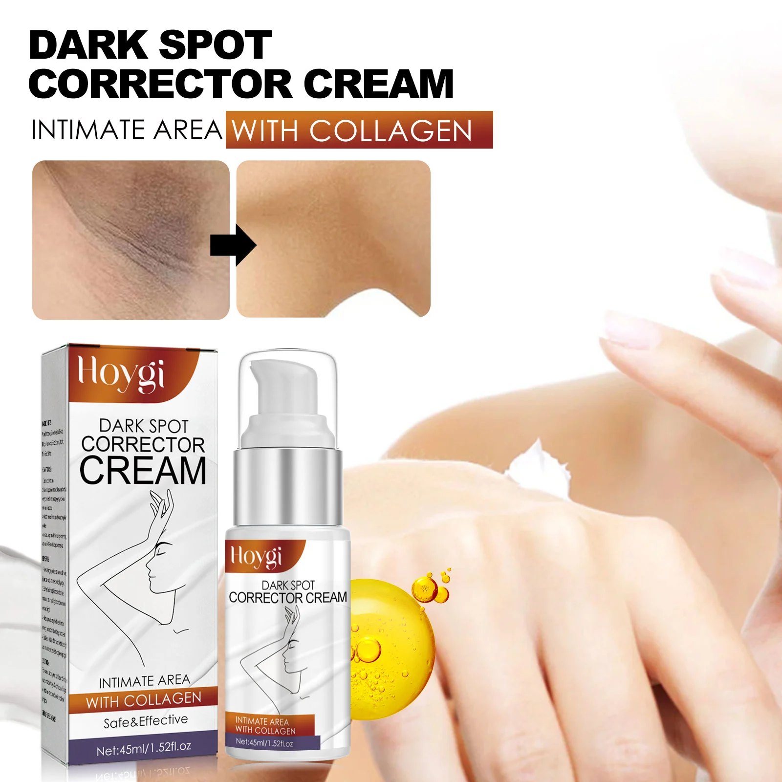 Hoygi Dark Spot Corrector Cream for Body Whitening and Moisturizing 2 dark spot corrector body cream cih 4vadgece desc 2