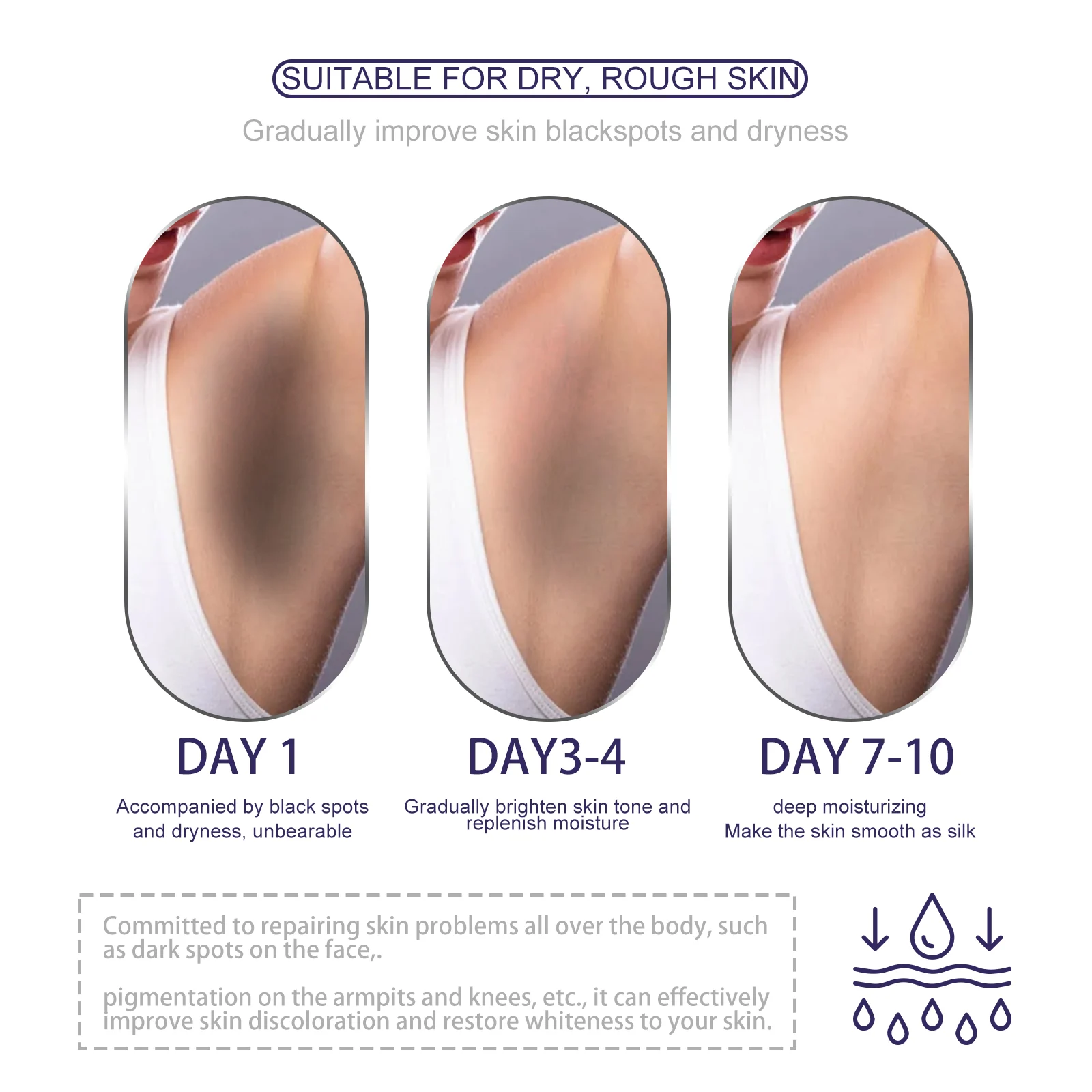 Dark Spot Corrector Cream 30g Brightens Skin Tone & Fades Hyperpigmentation 9 dark spot corrector cream 30g cih shmaeazy desc 9