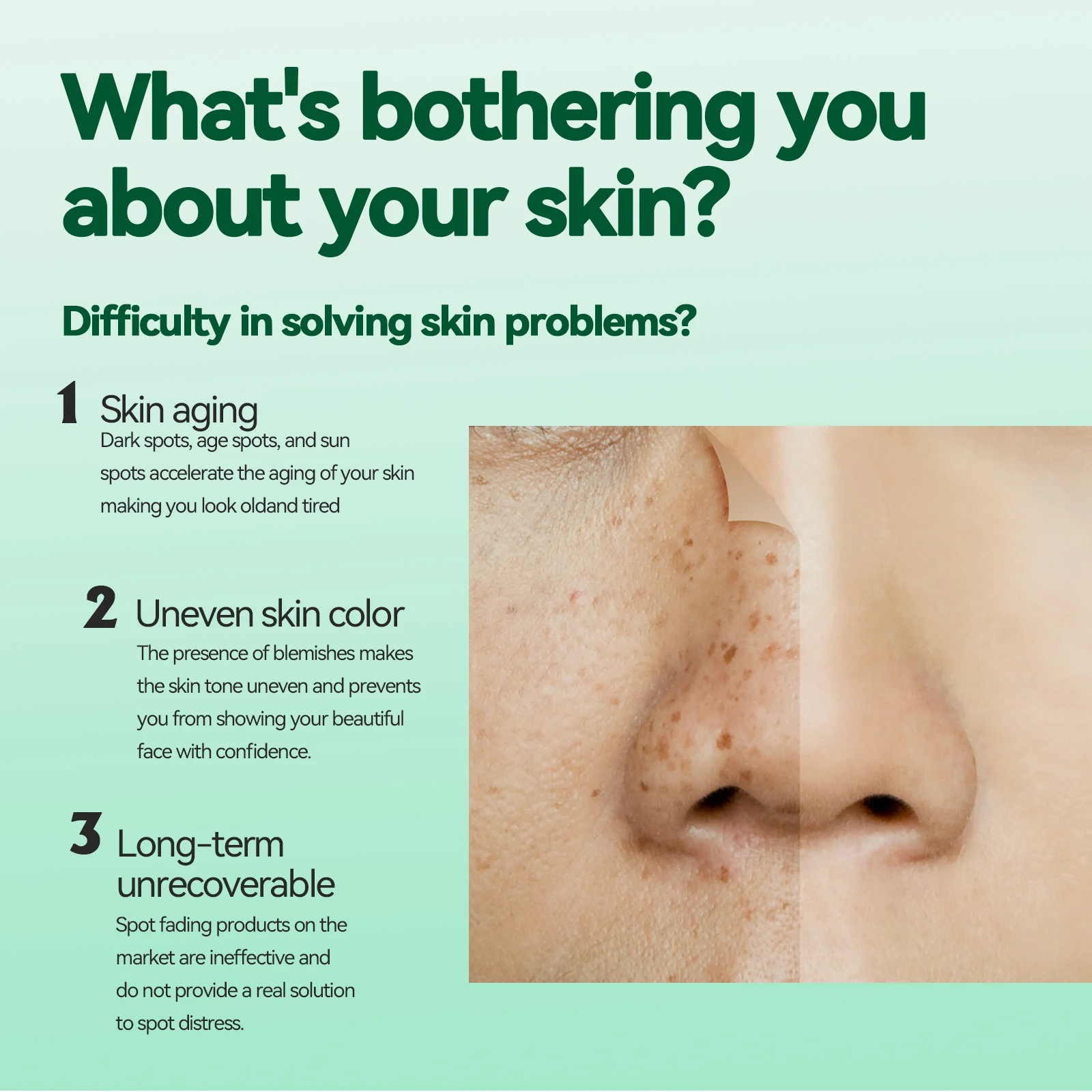Hoygi Dark Spot Corrector Serum - Fades Spots, Brightens & Evens Skin Tone 5 dark spot corrector serum cih jetqf6qy desc 5