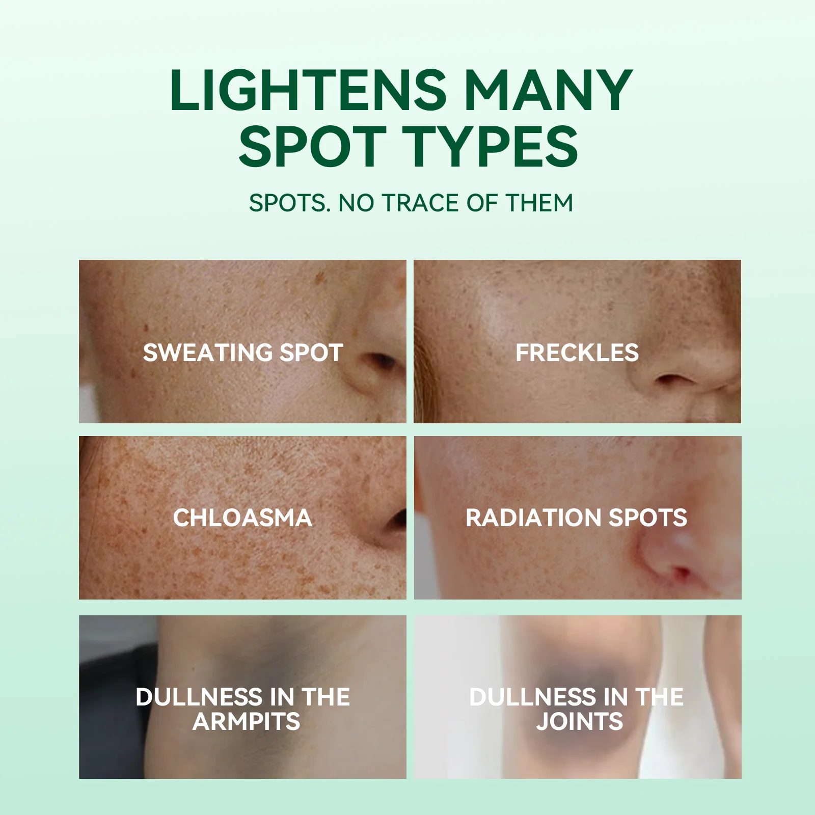 Hoygi Dark Spot Corrector Serum - Fades Spots, Brightens & Evens Skin Tone 7 dark spot corrector serum cih jetqf6qy desc 7