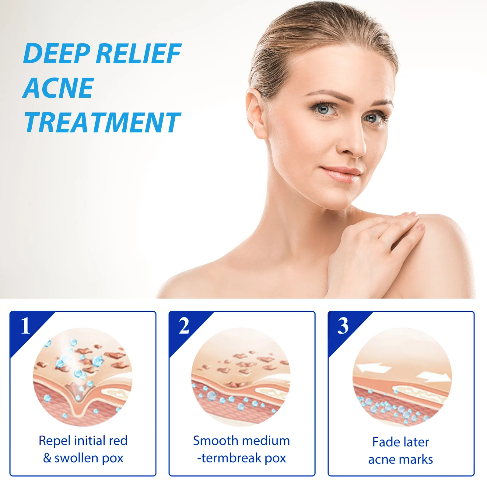 Dark Spot Remover Acne Treatment Lotion 30g for Fading Spots & Blemishes 6 dark spot remover acne treatment lotion 30g cih q2vepmnx desc 6