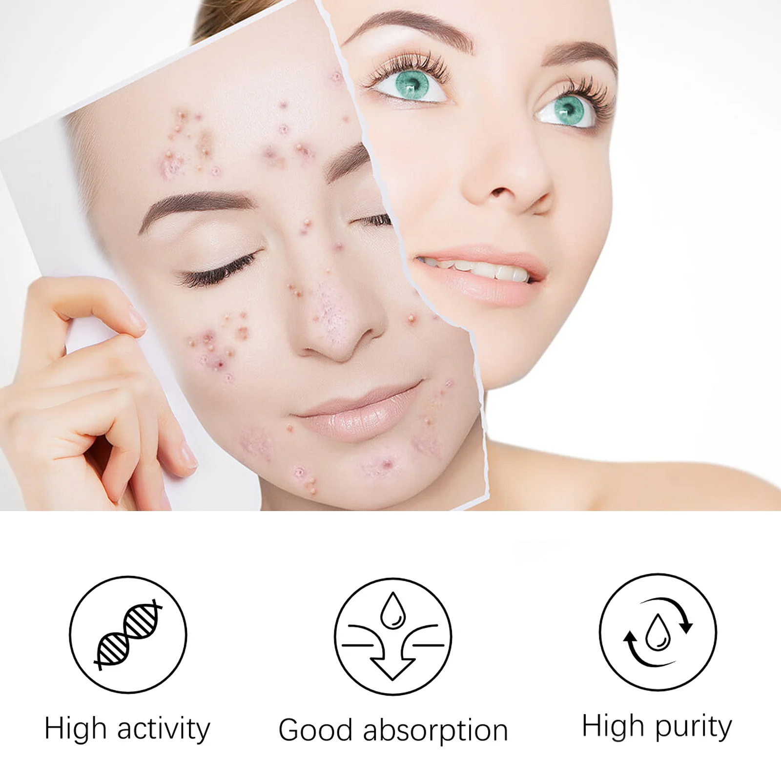 Dark Spot Remover Acne Treatment Lotion 30g for Fading Spots & Blemishes 8 dark spot remover acne treatment lotion 30g cih q2vepmnx desc 8