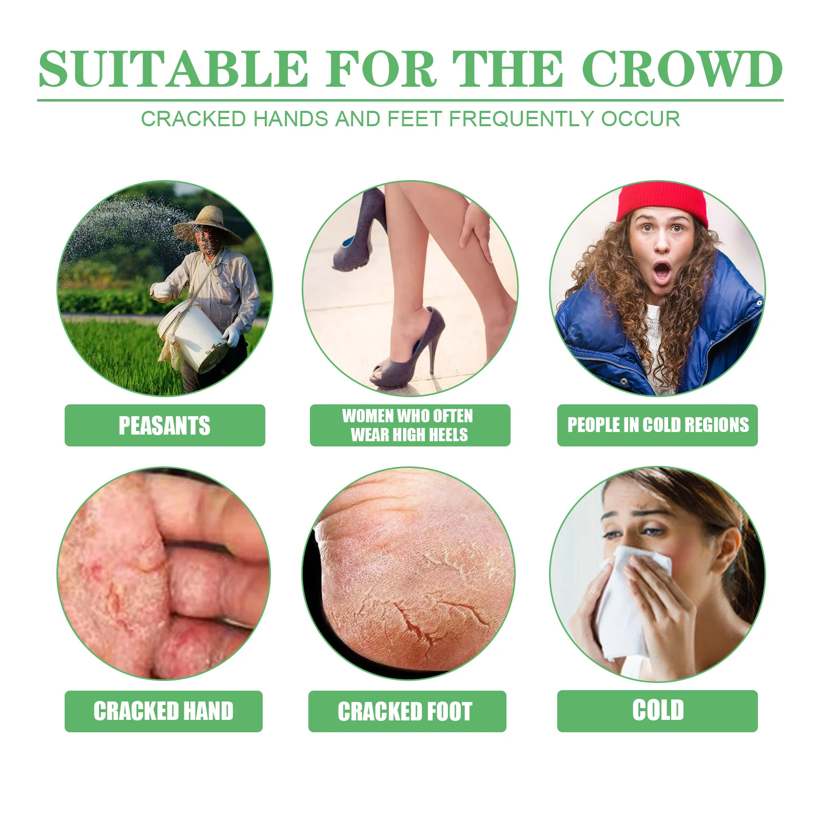 Dry Crack Protection Hand Foot Cream 30g Avocado Moisturizing Repair Balm for Chapped Skin 5 dry crack protection hand foot cream 30g avocado cih 3v5w7frv desc 5