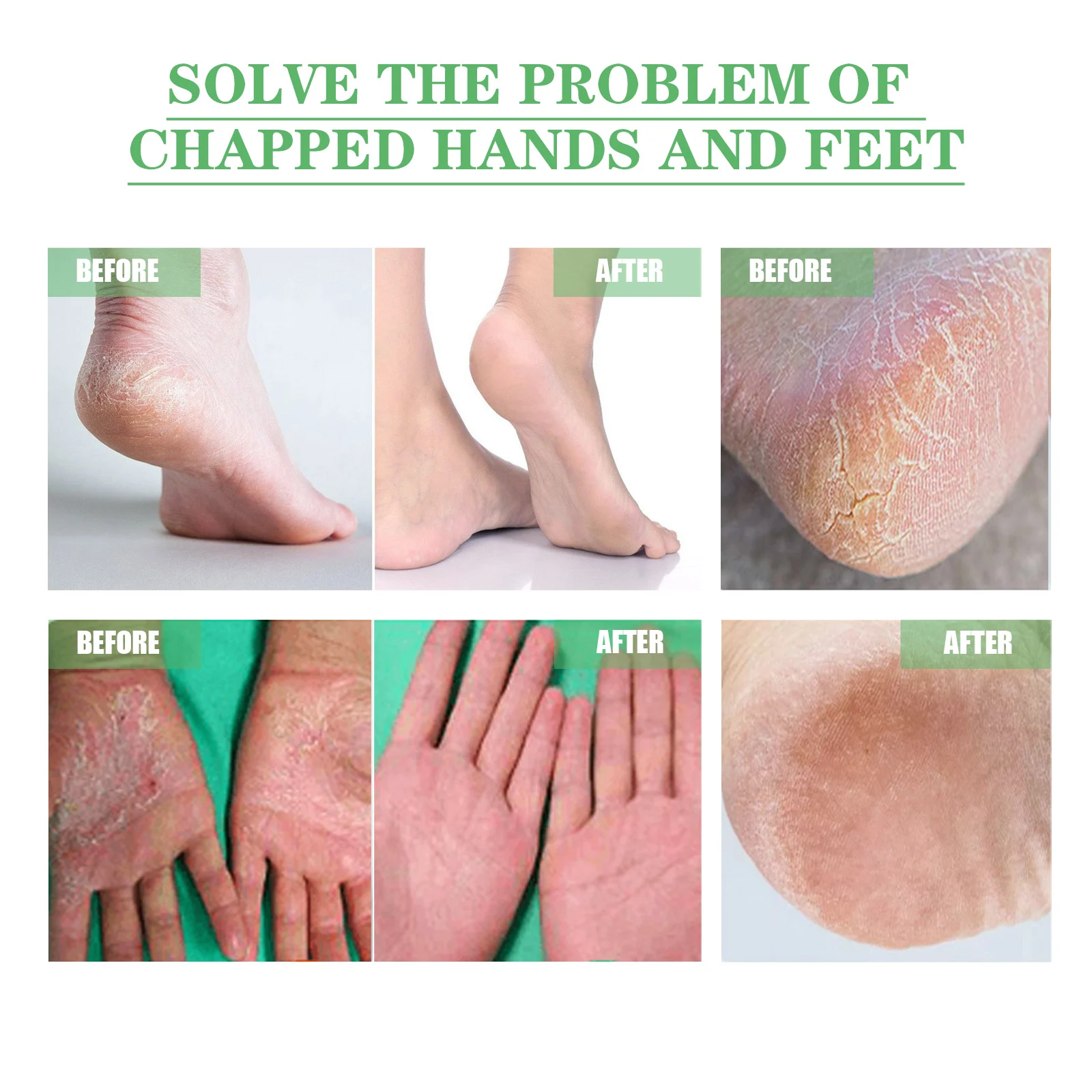 Dry Crack Protection Hand Foot Cream 30g Avocado Moisturizing Repair Balm for Chapped Skin 8 dry crack protection hand foot cream 30g avocado cih 3v5w7frv desc 8